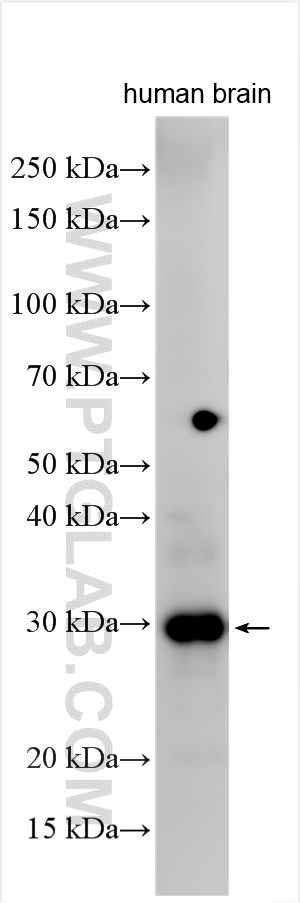 Western Blot (WB) analysis of various lysates using RAB12 Polyclonal antibody (29927-1-AP)