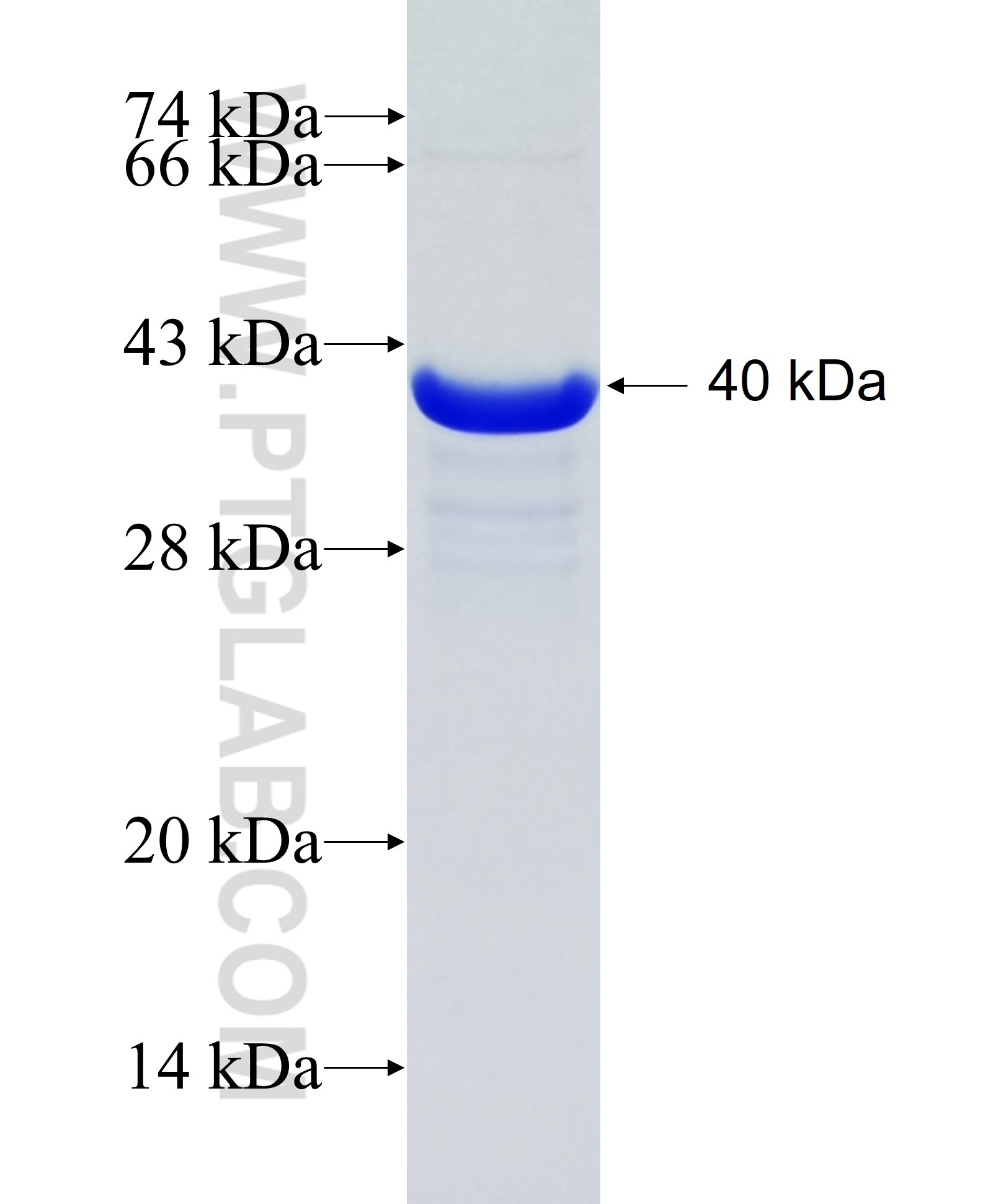 RAB12 fusion protein Ag31627 SDS-PAGE