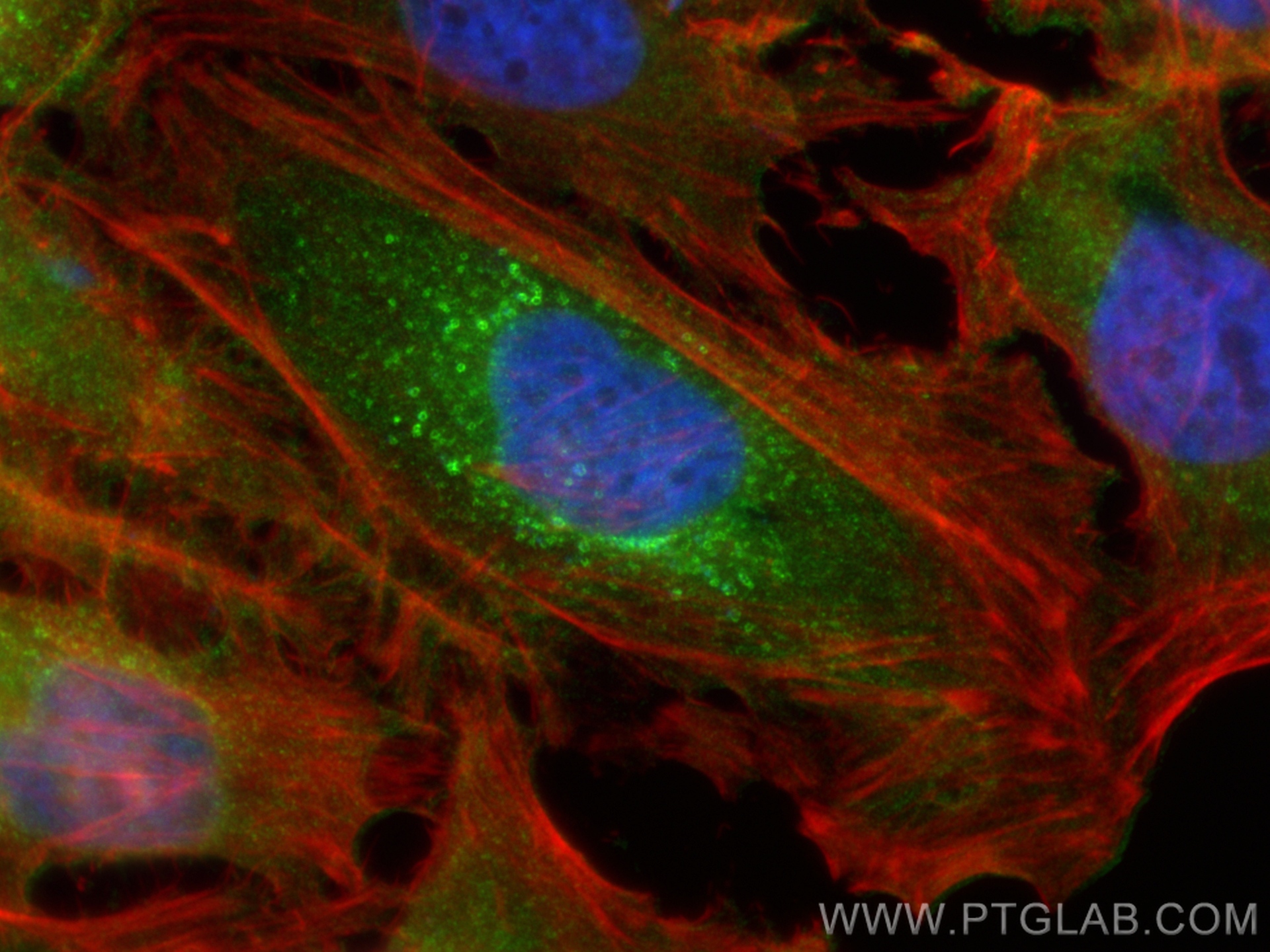 Immunofluorescence (IF) / fluorescent staining of HeLa cells using RAB13 Polyclonal antibody (11718-1-AP)