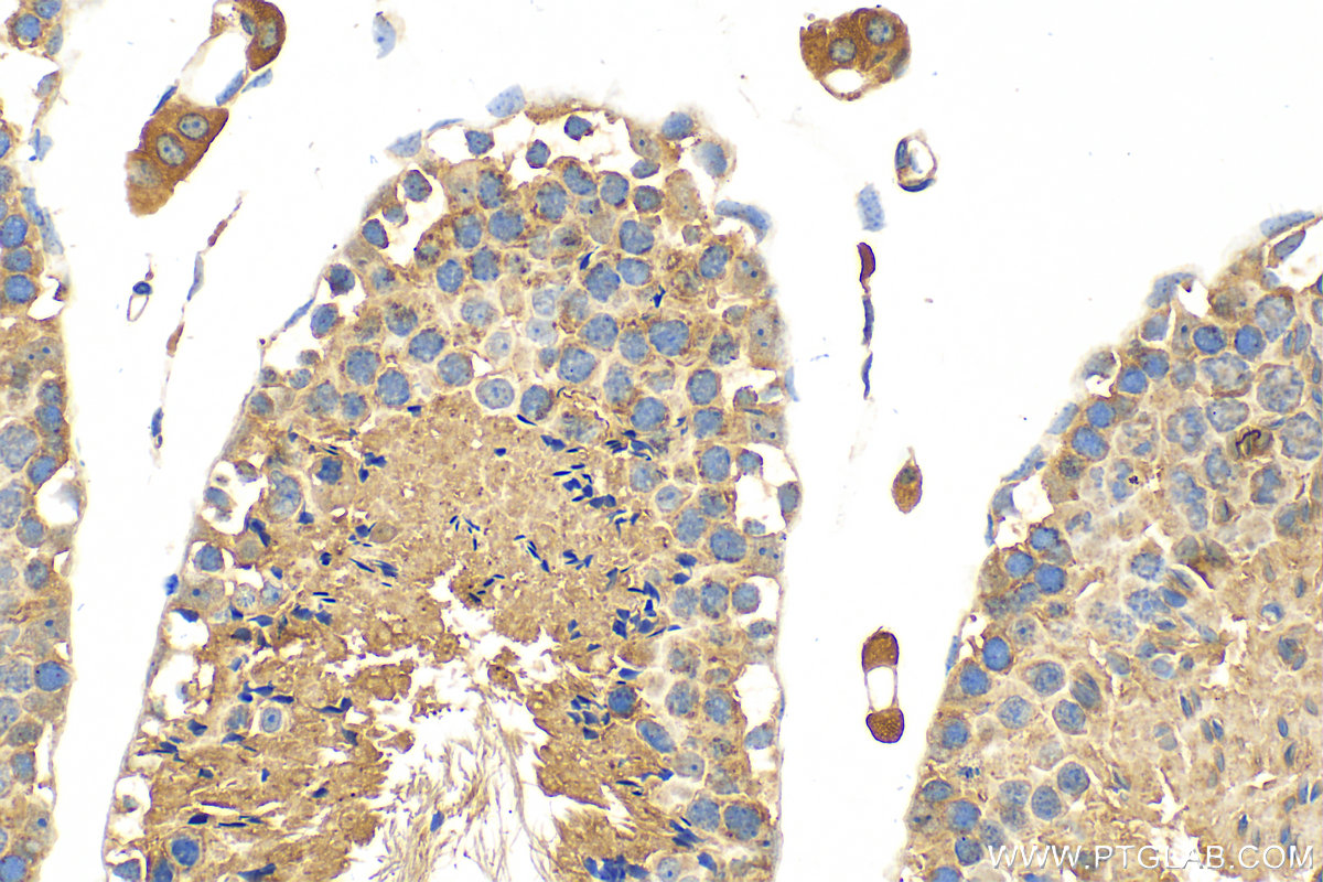 Immunohistochemistry (IHC) staining of mouse testis tissue using RAB13 Polyclonal antibody (31416-1-AP)