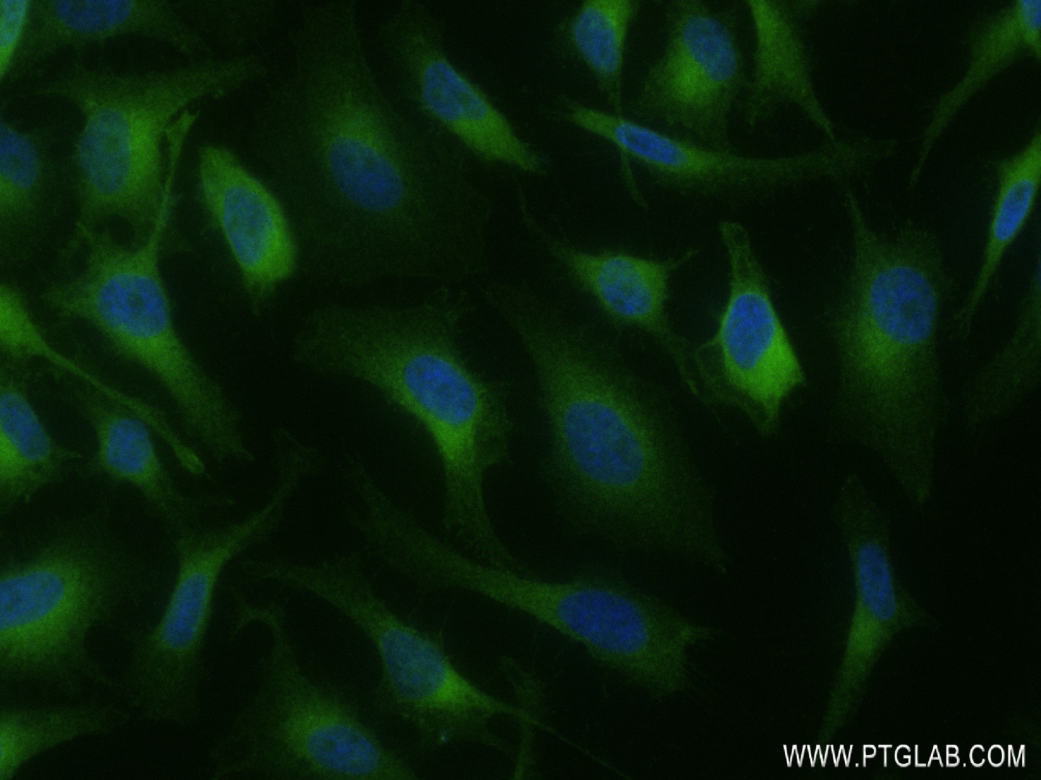 Immunofluorescence (IF) / fluorescent staining of HeLa cells using RAB13 Recombinant antibody (83336-2-RR)