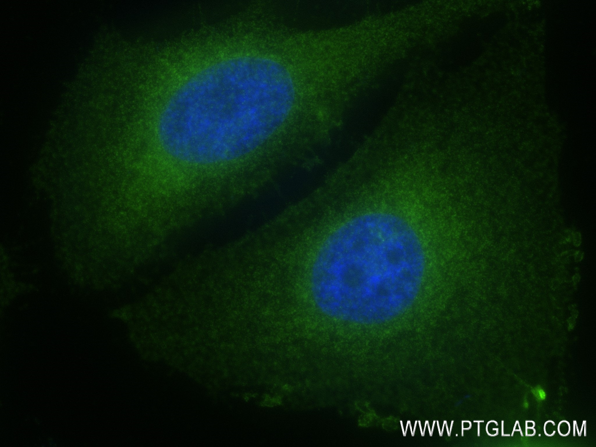 Immunofluorescence (IF) / fluorescent staining of HeLa cells using RAB13 Recombinant antibody (83336-2-RR)