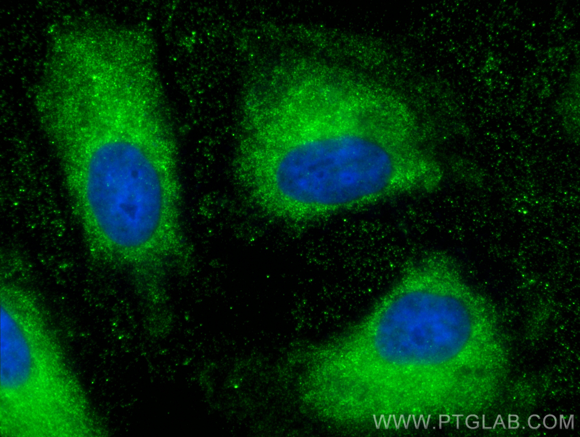 Immunofluorescence (IF) / fluorescent staining of HeLa cells using RAB14 Monoclonal antibody (67953-1-Ig)