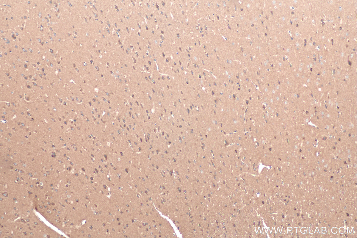 Immunohistochemistry (IHC) staining of rat brain tissue using RAB1B Monoclonal antibody (67837-1-Ig)