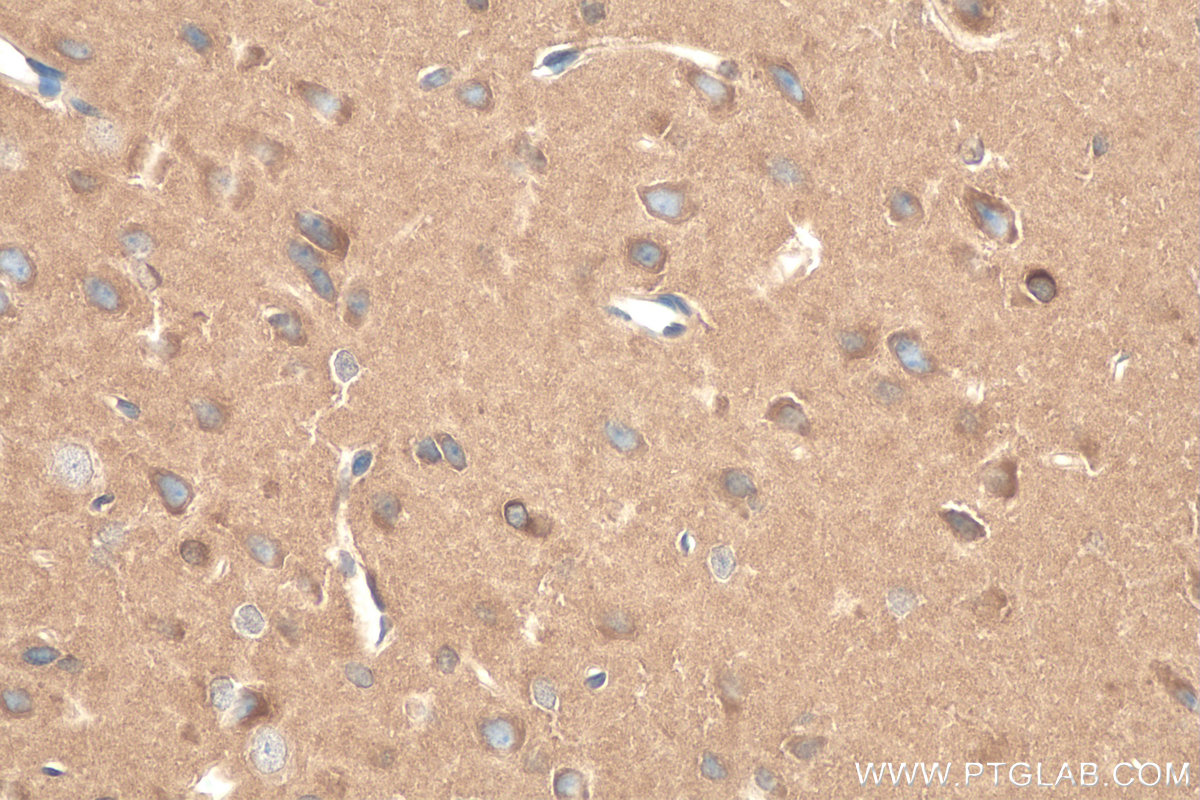 Immunohistochemistry (IHC) staining of rat brain tissue using RAB1B Monoclonal antibody (67837-1-Ig)