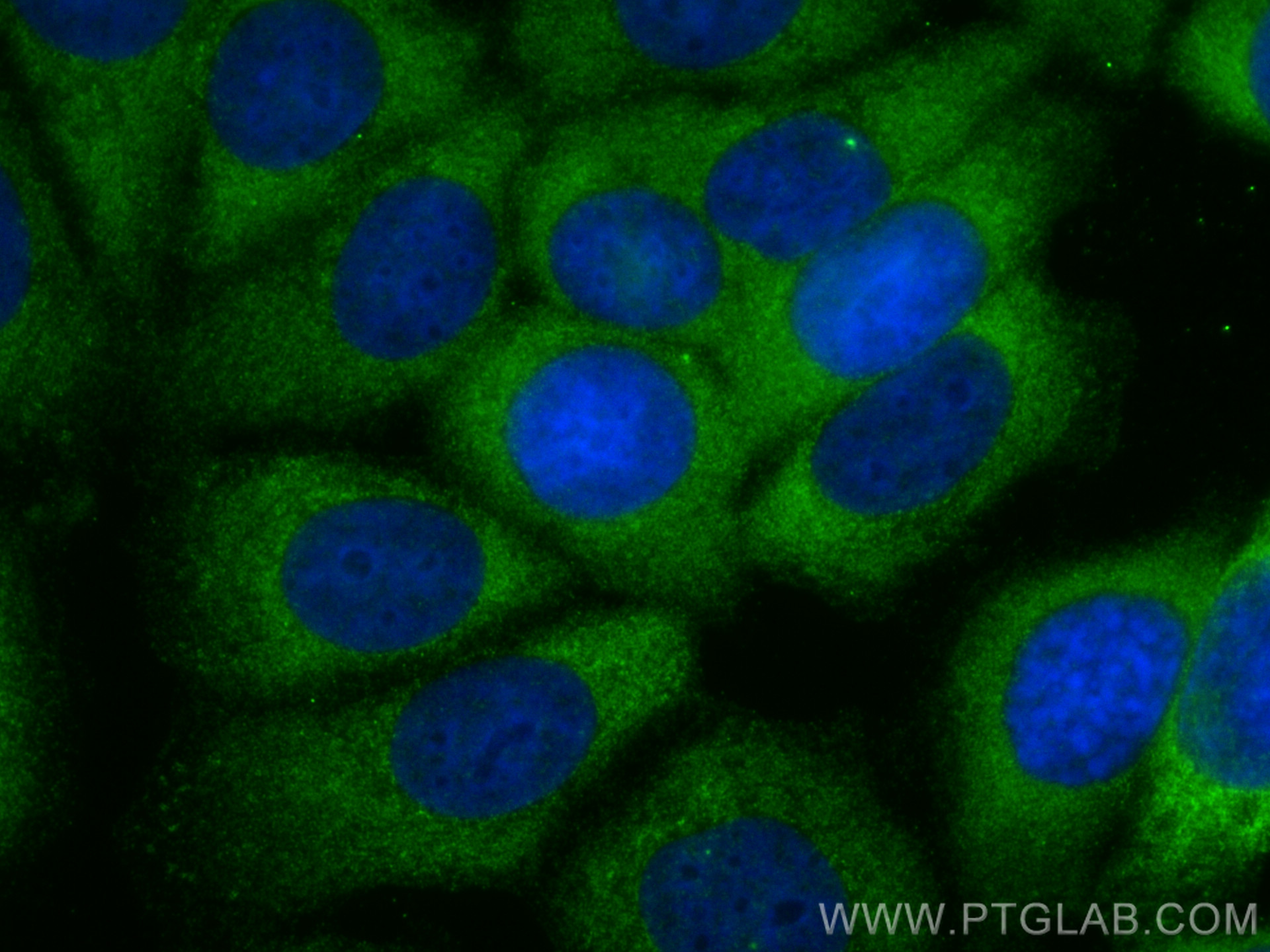 Immunofluorescence (IF) / fluorescent staining of MCF-7 cells using RAB26 Polyclonal antibody (14284-1-AP)