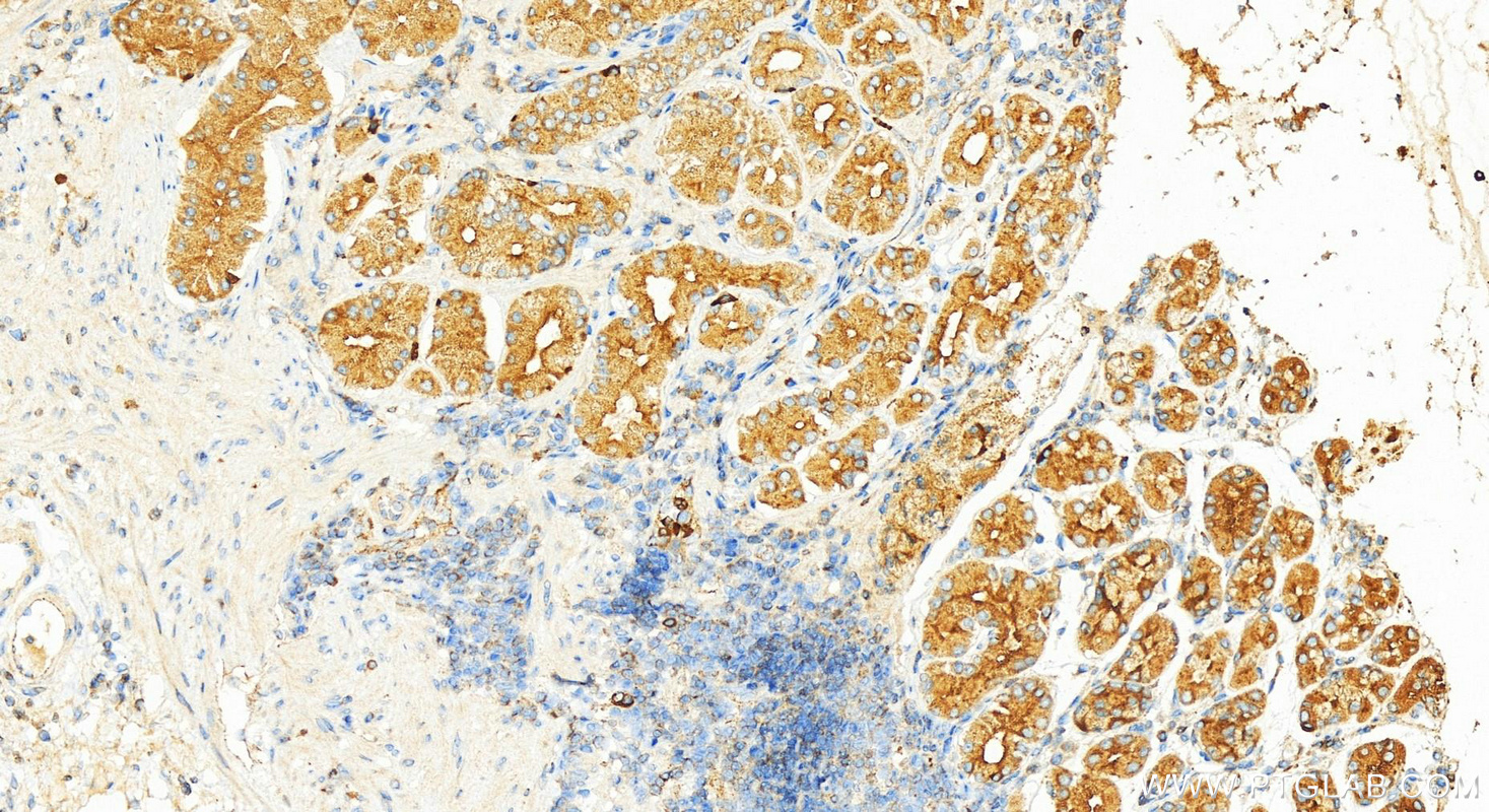 Immunohistochemistry (IHC) staining of human stomach tissue using RAB27A Polyclonal antibody (17817-1-AP)