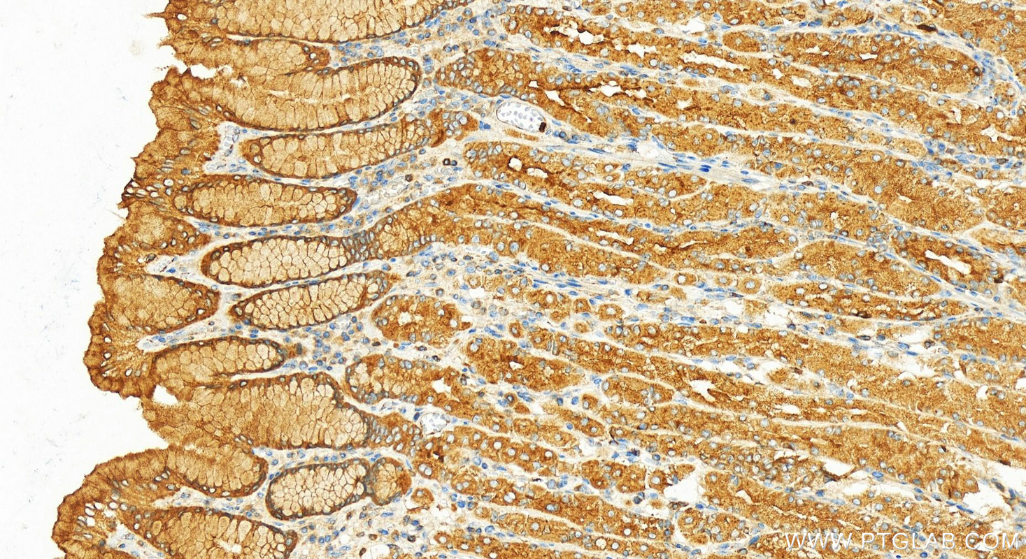 Immunohistochemistry (IHC) staining of human stomach tissue using RAB27A Polyclonal antibody (17817-1-AP)