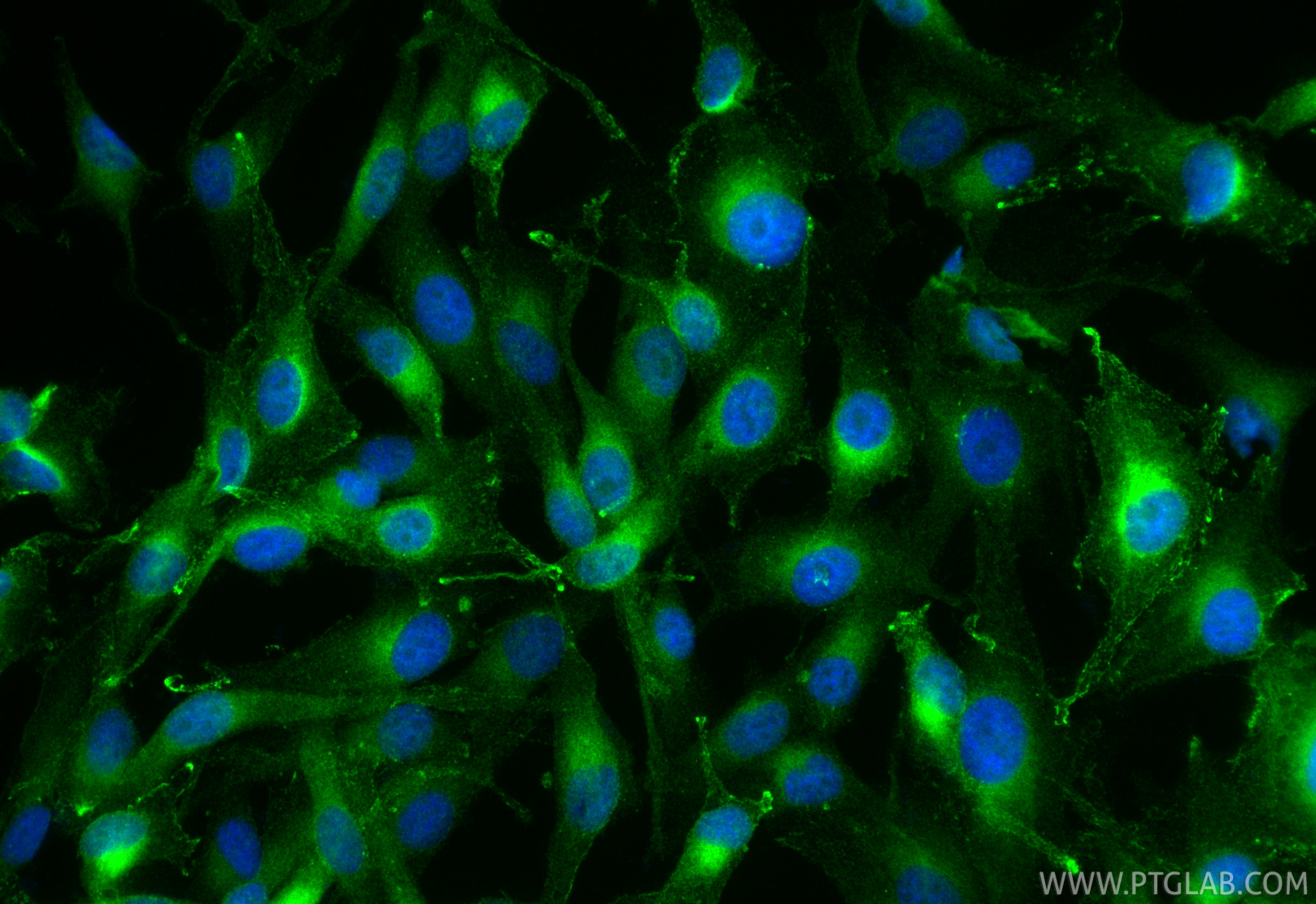 Immunofluorescence (IF) / fluorescent staining of SK-MEL-28 cells using RAB27A Polyclonal antibody (17817-1-AP)