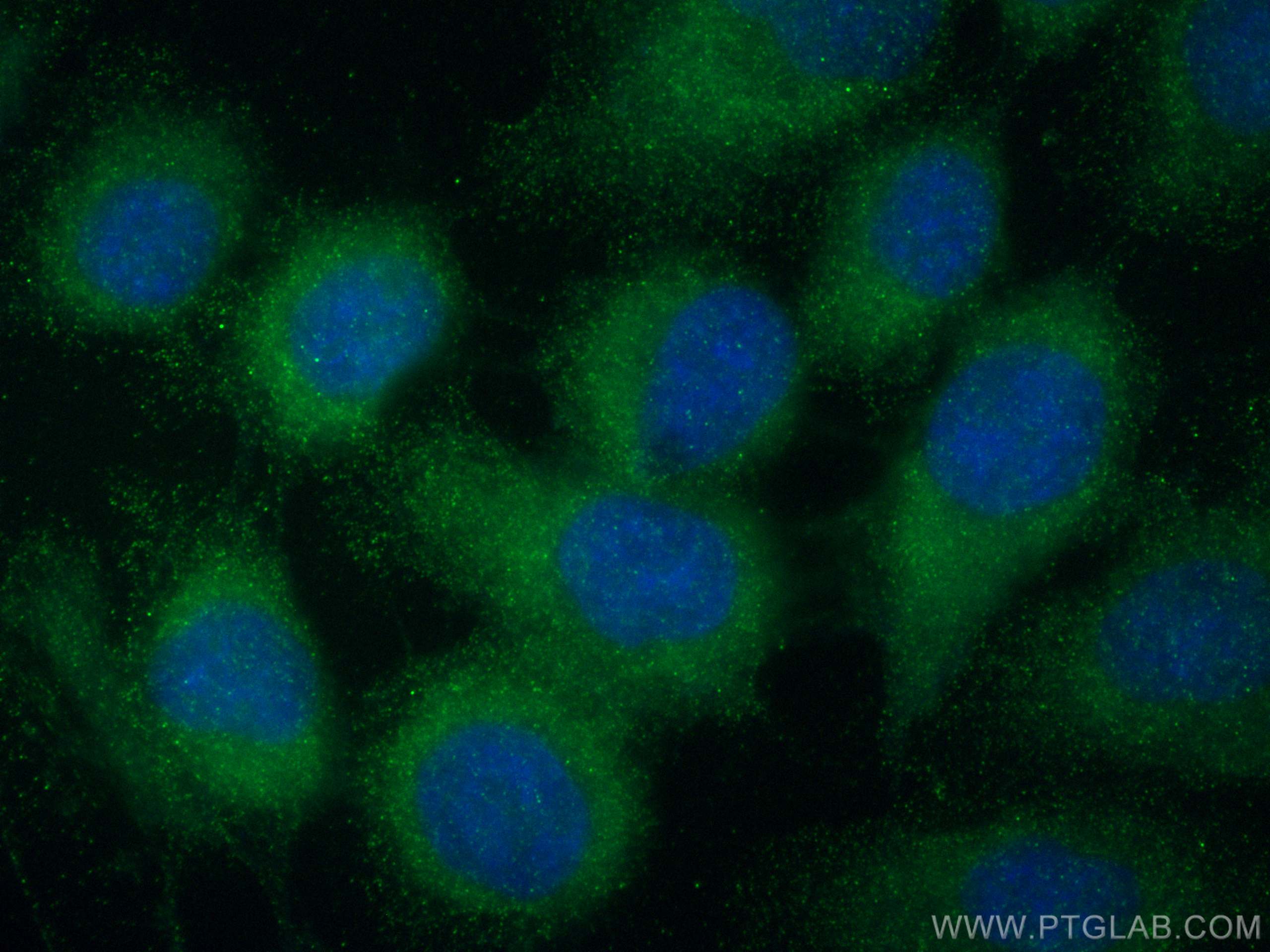 Immunofluorescence (IF) / fluorescent staining of A431 cells using RAB27B Monoclonal antibody (66944-1-Ig)