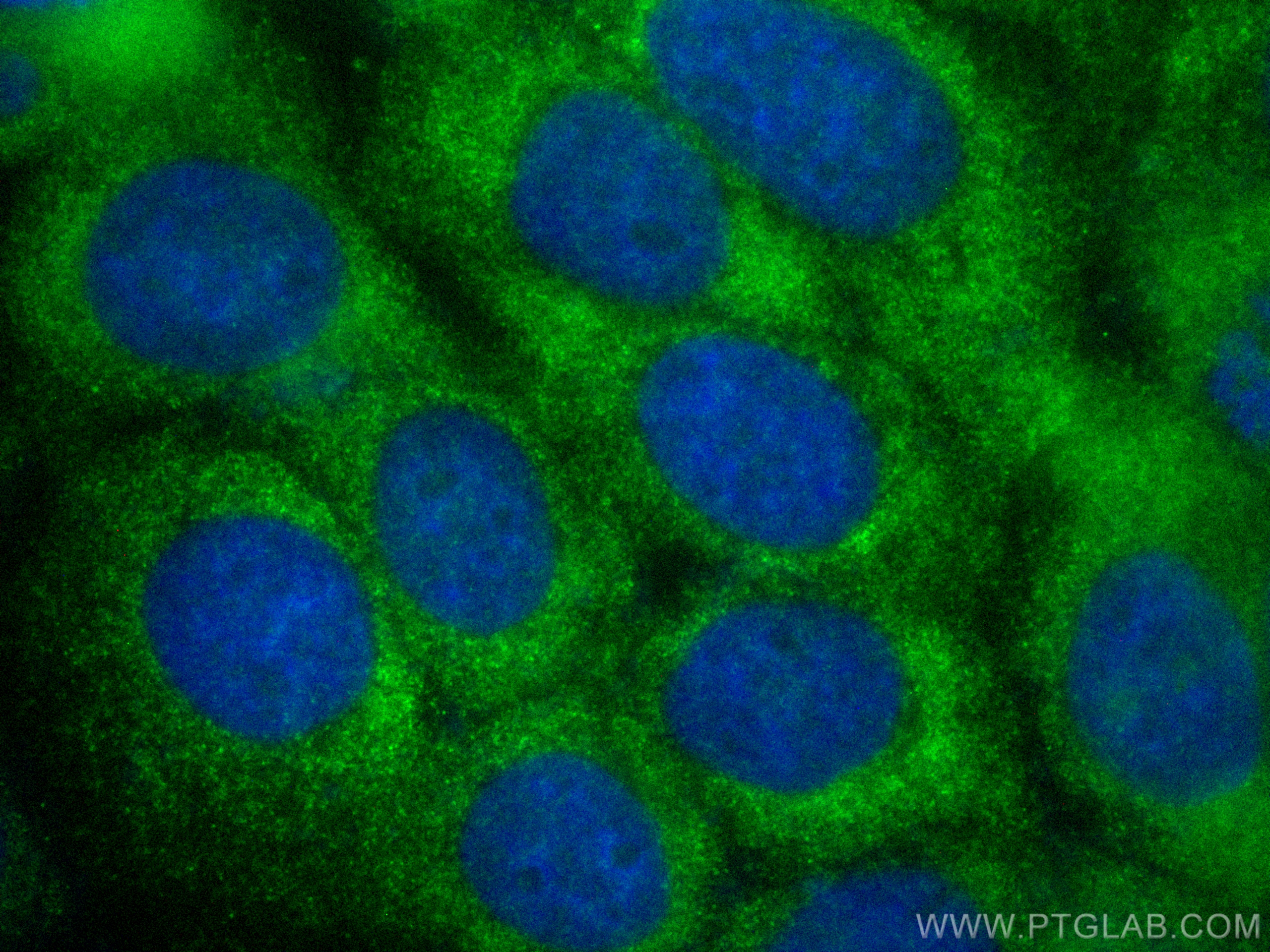 Immunofluorescence (IF) / fluorescent staining of A431 cells using CoraLite® Plus 488-conjugated RAB27B Monoclonal an (CL488-66944)