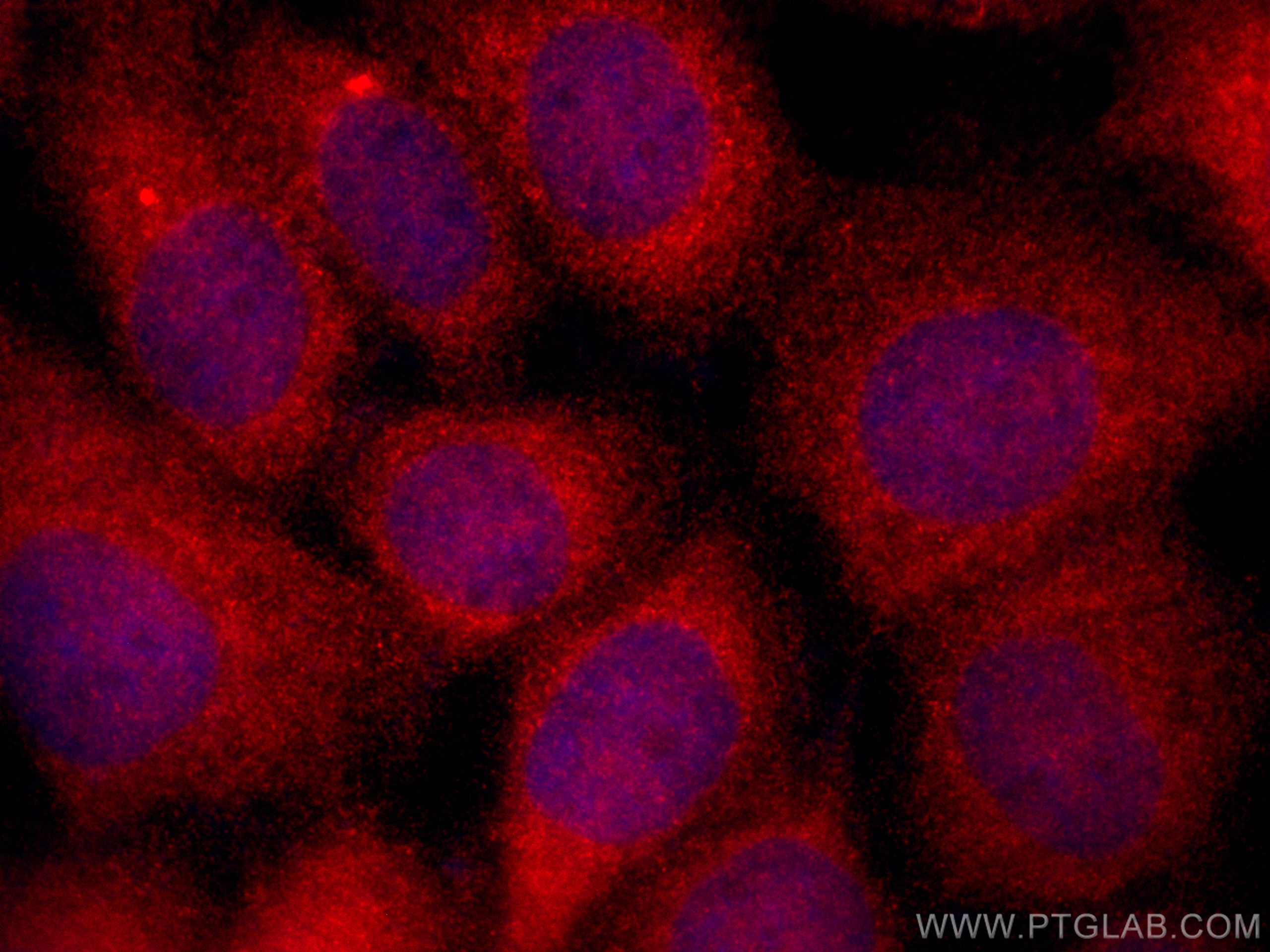 Immunofluorescence (IF) / fluorescent staining of A431 cells using CoraLite®594-conjugated RAB27B Polyclonal antibody (CL594-13412)