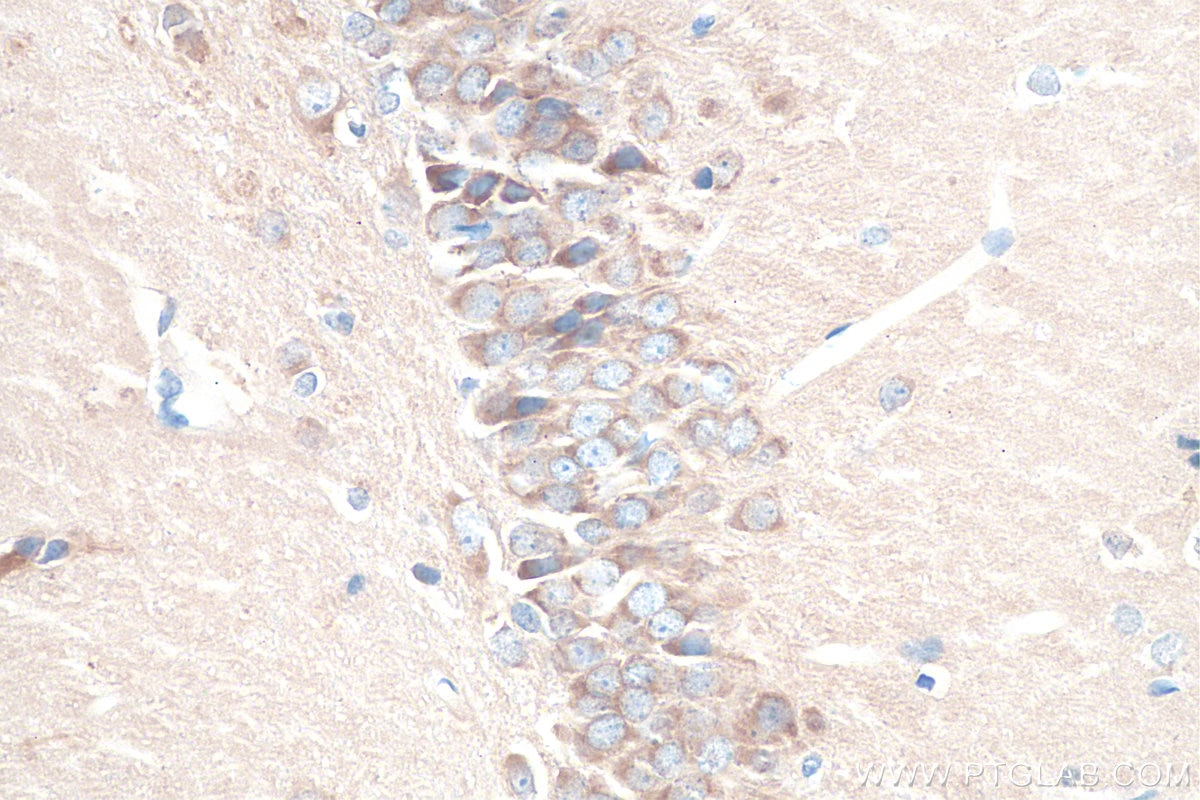 Immunohistochemistry (IHC) staining of rat brain tissue using RAB2A/B Polyclonal antibody (15420-1-AP)
