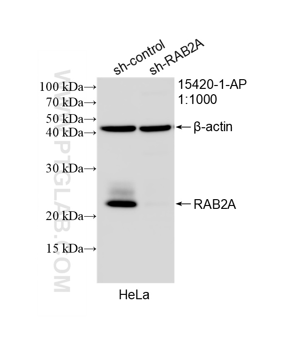 Western Blot (WB) analysis of HeLa cells using RAB2 Polyclonal antibody (15420-1-AP)