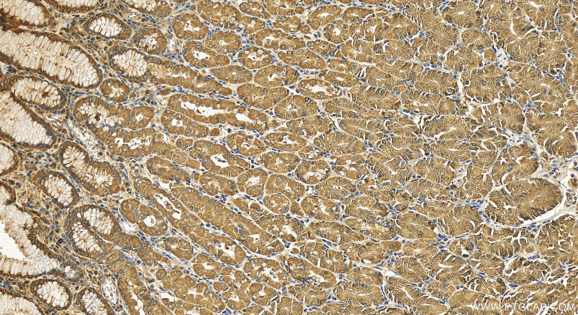 Immunohistochemistry (IHC) staining of human stomach tissue using RAB2B Polyclonal antibody (11756-1-AP)