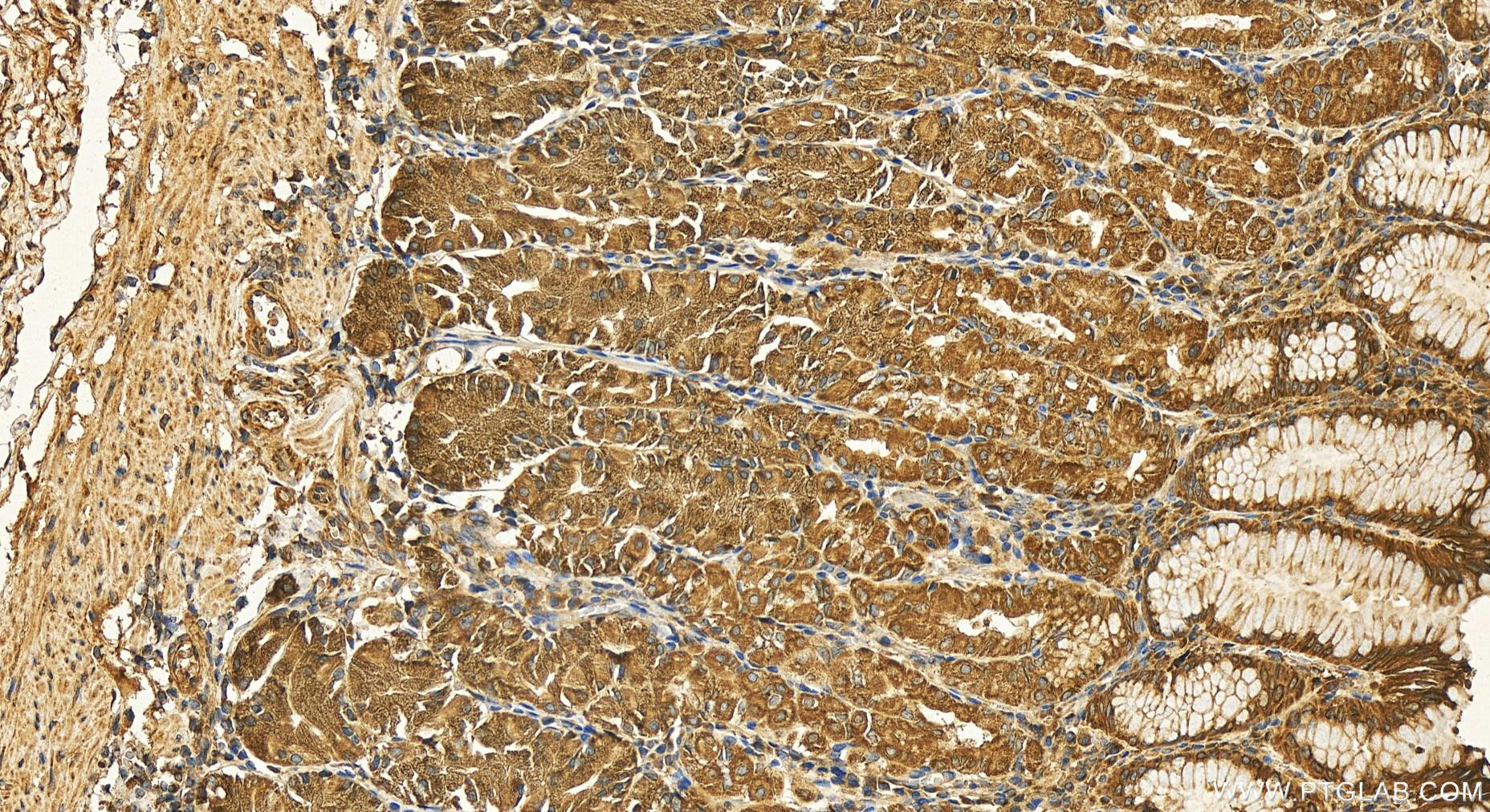 Immunohistochemistry (IHC) staining of human stomach tissue using RAB2B Polyclonal antibody (11756-1-AP)