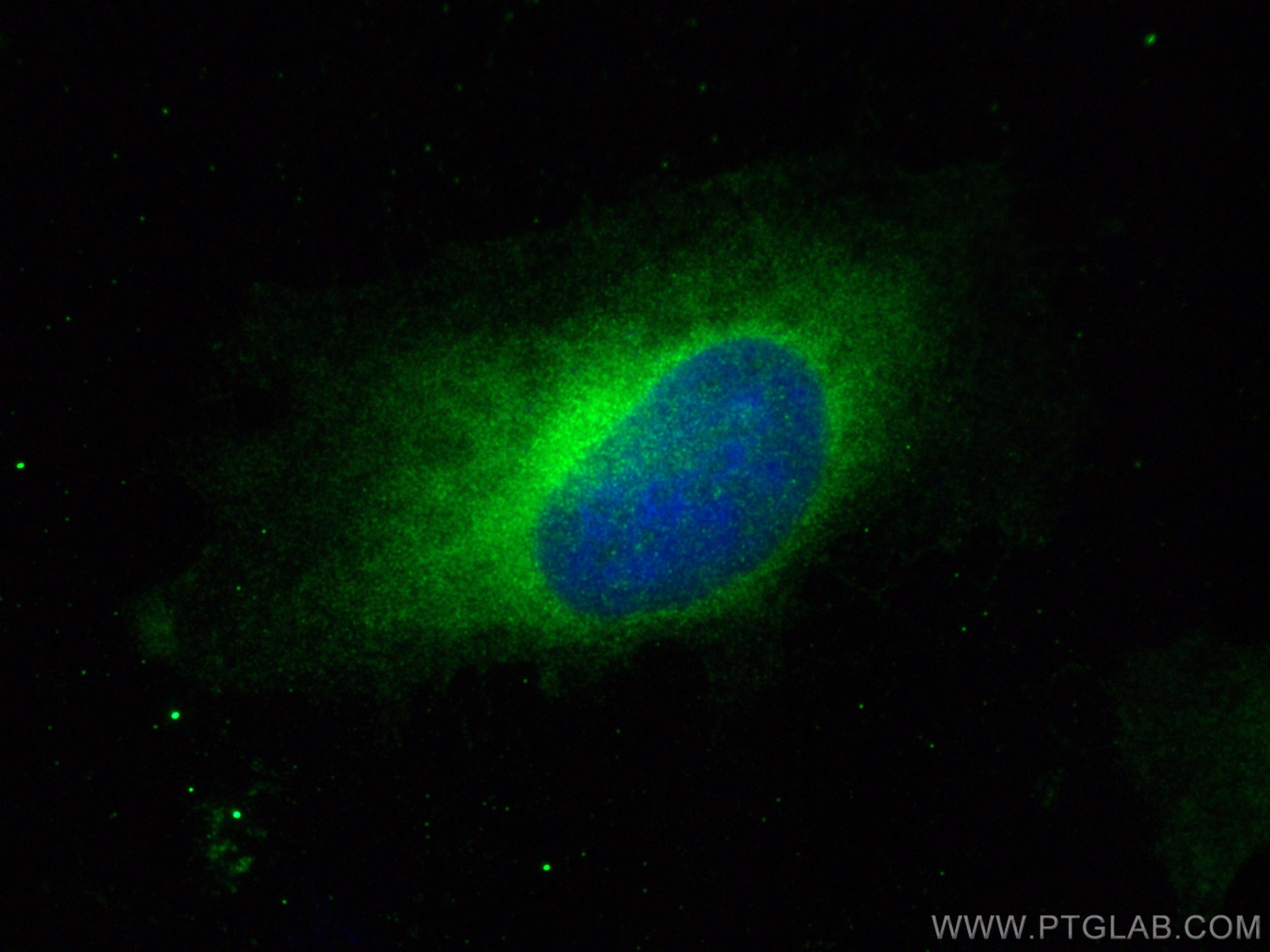 Immunofluorescence (IF) / fluorescent staining of HeLa cells using RAB32 Recombinant antibody (82960-1-RR)