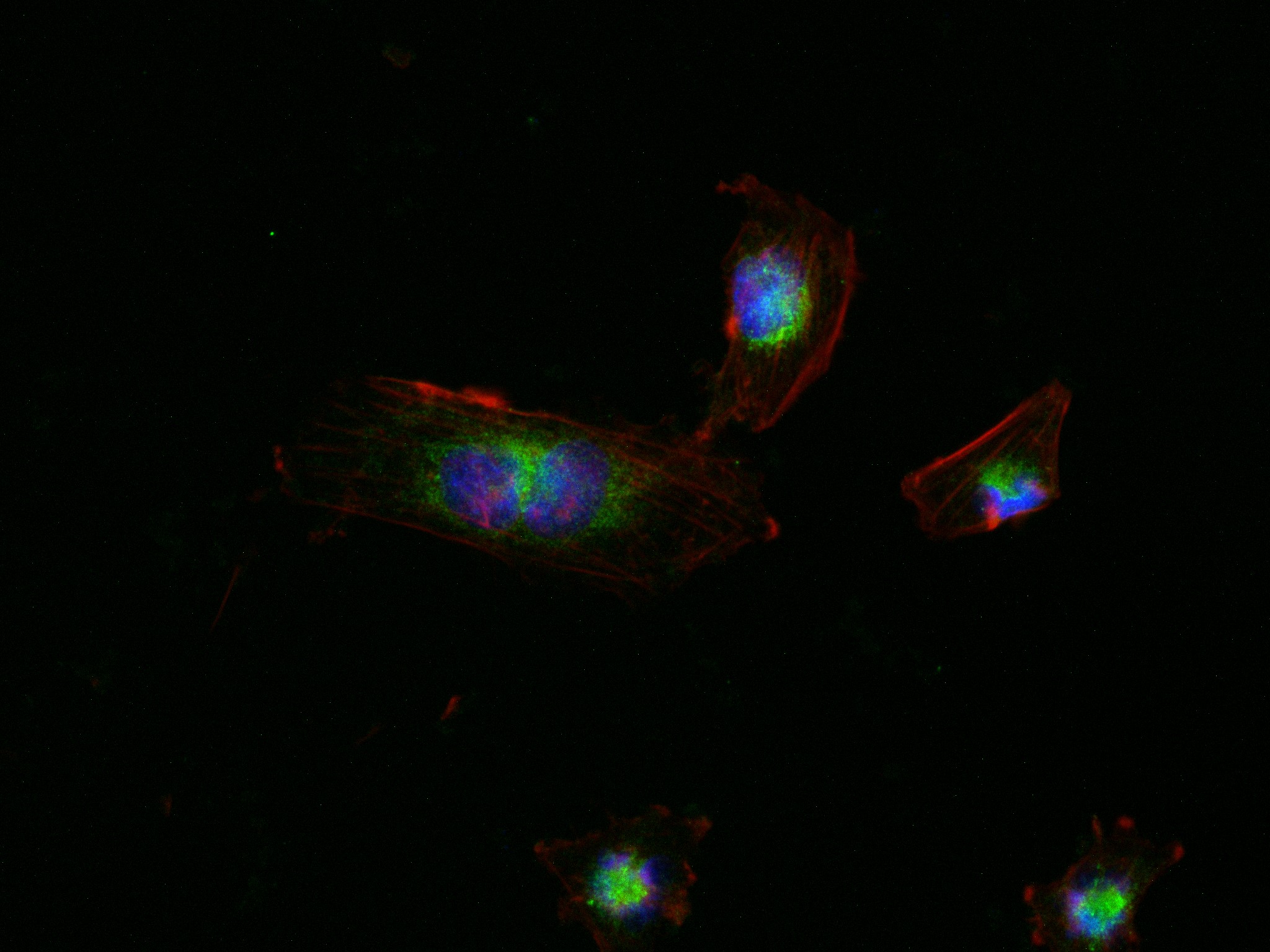 Immunofluorescence (IF) / fluorescent staining of U-251 cells using RAB32 Recombinant antibody (82960-5-RR)