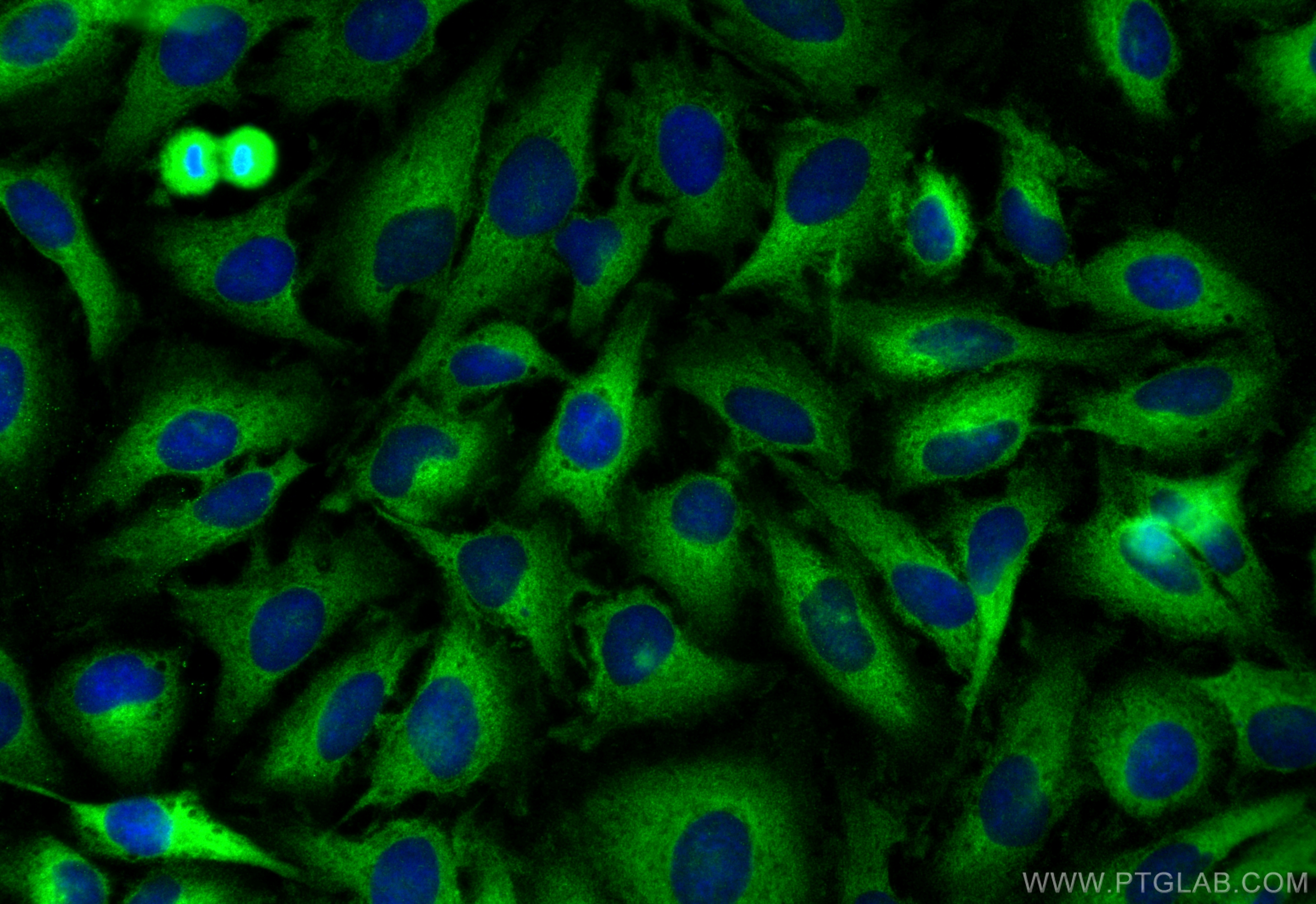 Immunofluorescence (IF) / fluorescent staining of HeLa cells using RAB32 Recombinant antibody (82960-5-RR)