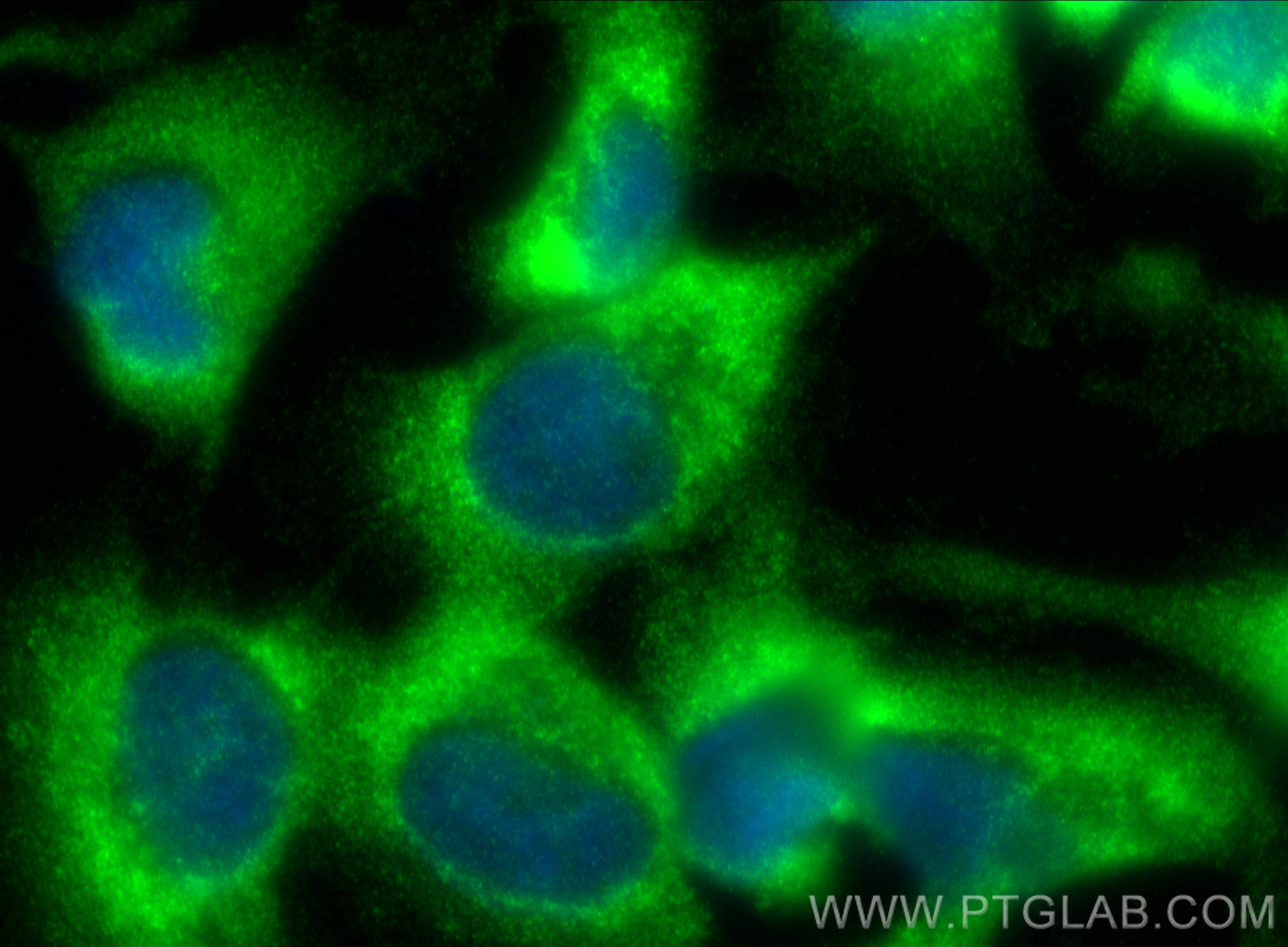 Immunofluorescence (IF) / fluorescent staining of U-251 cells using RAB32 Recombinant antibody (82960-5-RR)