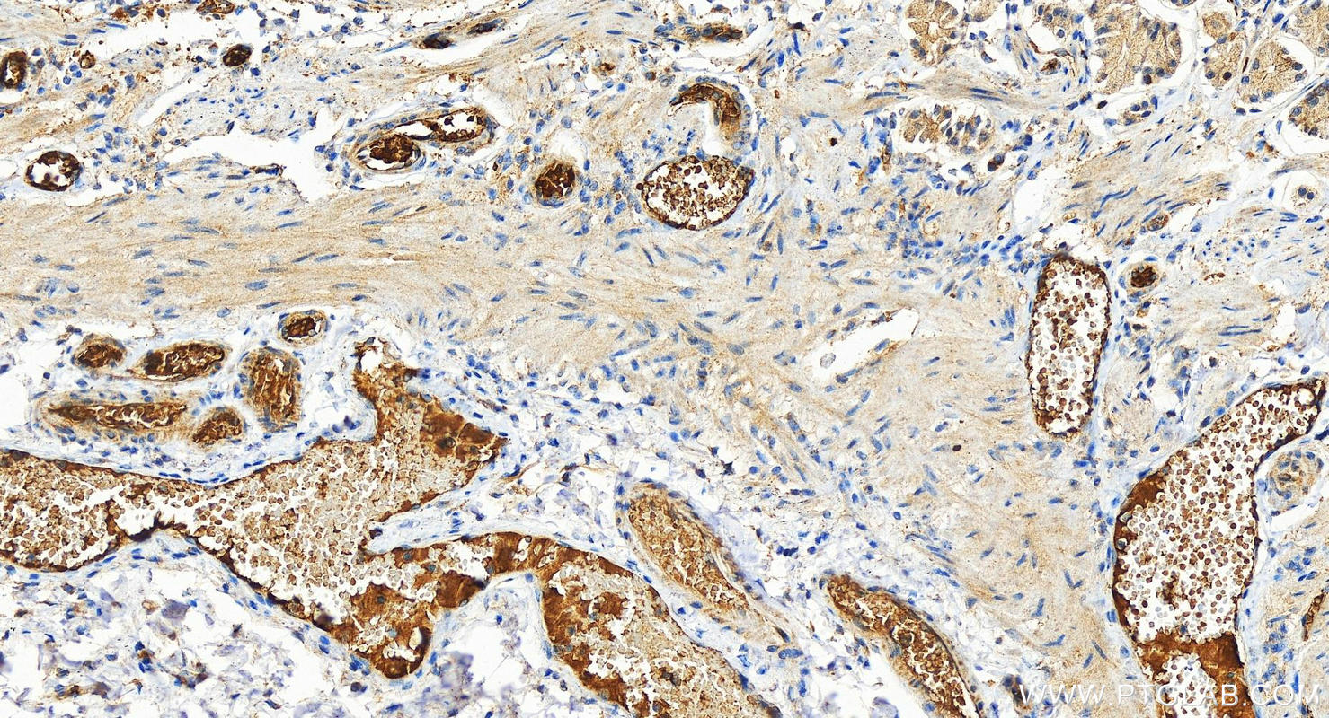 Immunohistochemistry (IHC) staining of human stomach tissue using RAB33B Polyclonal antibody (27349-1-AP)