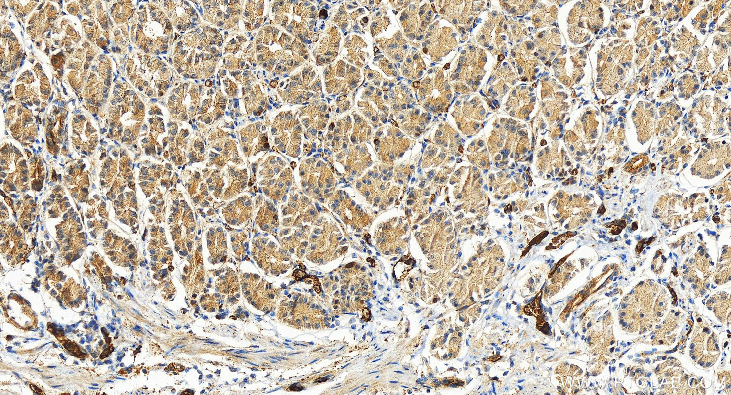 Immunohistochemistry (IHC) staining of human stomach tissue using RAB33B Polyclonal antibody (27349-1-AP)