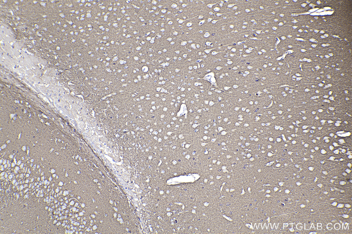 Immunohistochemistry (IHC) staining of mouse brain tissue using RAB3A Monoclonal antibody (68052-1-Ig)