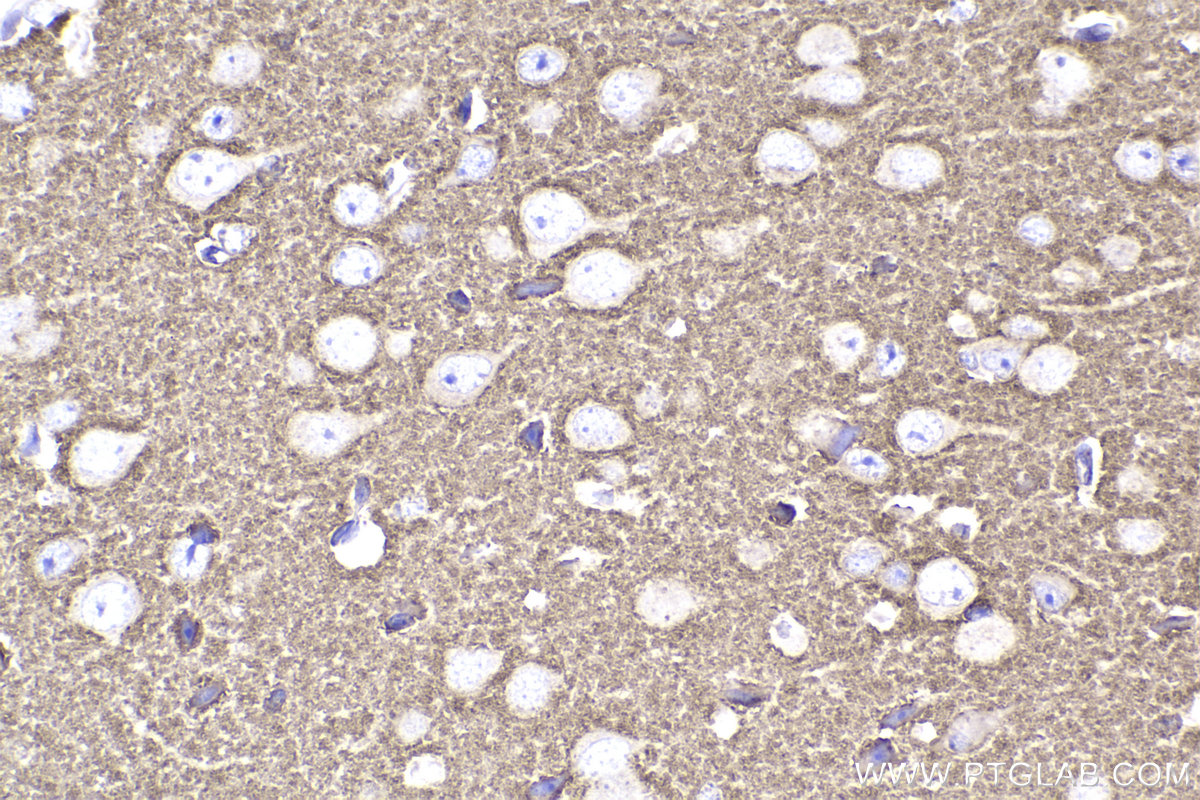 Immunohistochemistry (IHC) staining of mouse brain tissue using RAB3A Monoclonal antibody (68052-1-Ig)