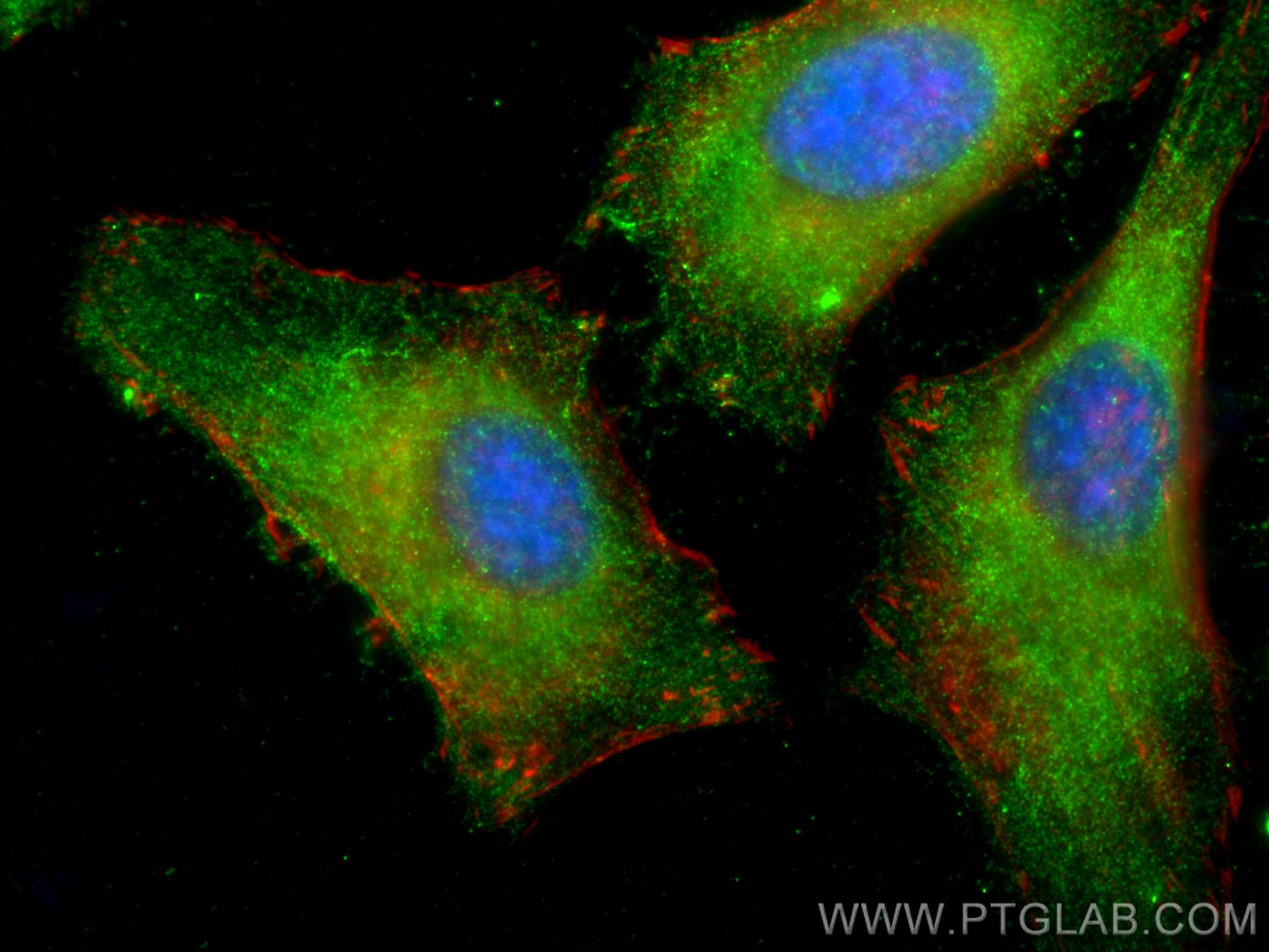 Immunofluorescence (IF) / fluorescent staining of HeLa cells using RAB3A-specific Polyclonal antibody (16865-1-AP)