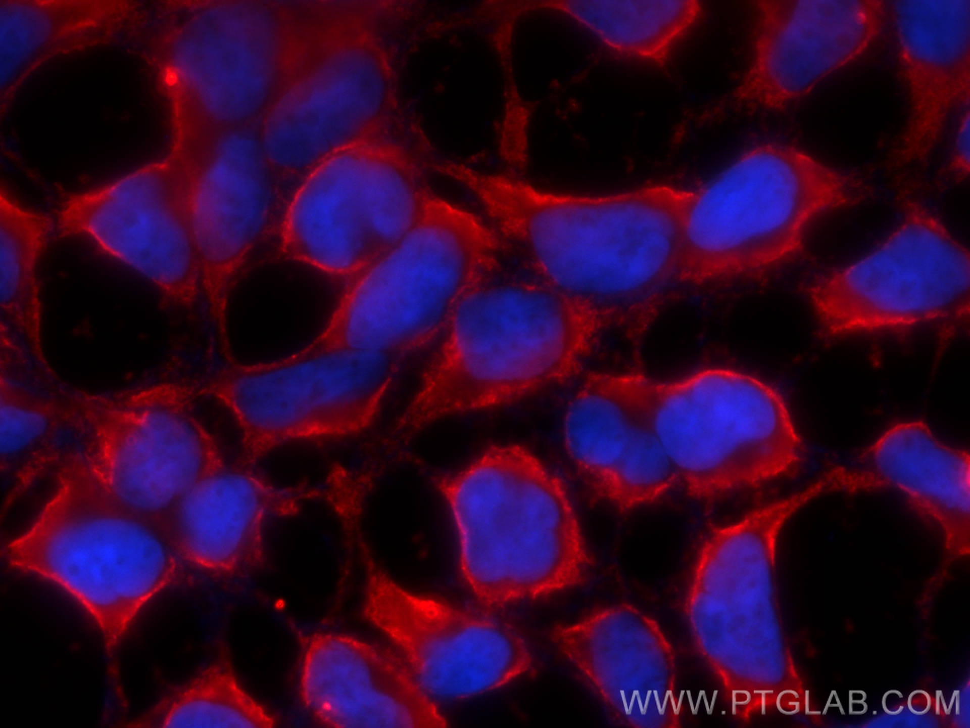 Immunofluorescence (IF) / fluorescent staining of HEK-293 cells using CoraLite®594-conjugated RAB3GAP1 Monoclonal antibo (CL594-66688)