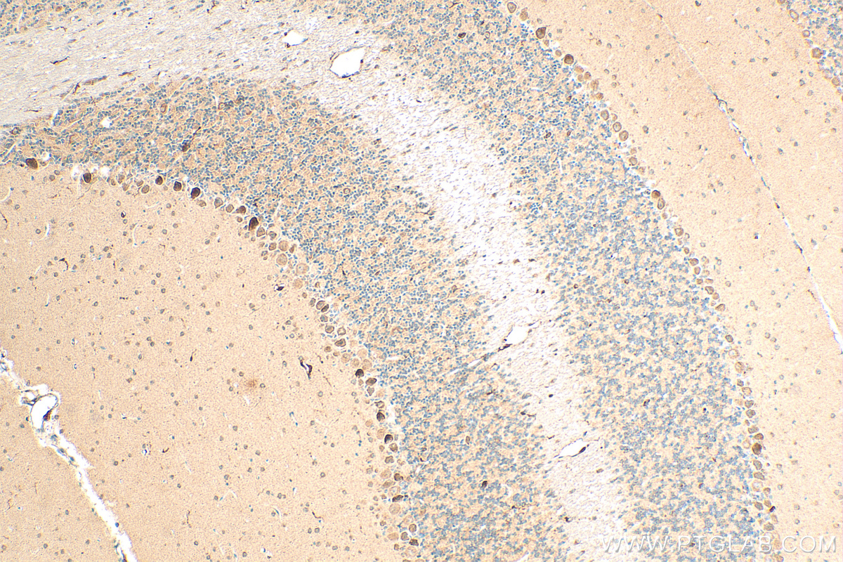 Immunohistochemistry (IHC) staining of mouse cerebellum tissue using RAB3IL1 Polyclonal antibody (17827-1-AP)