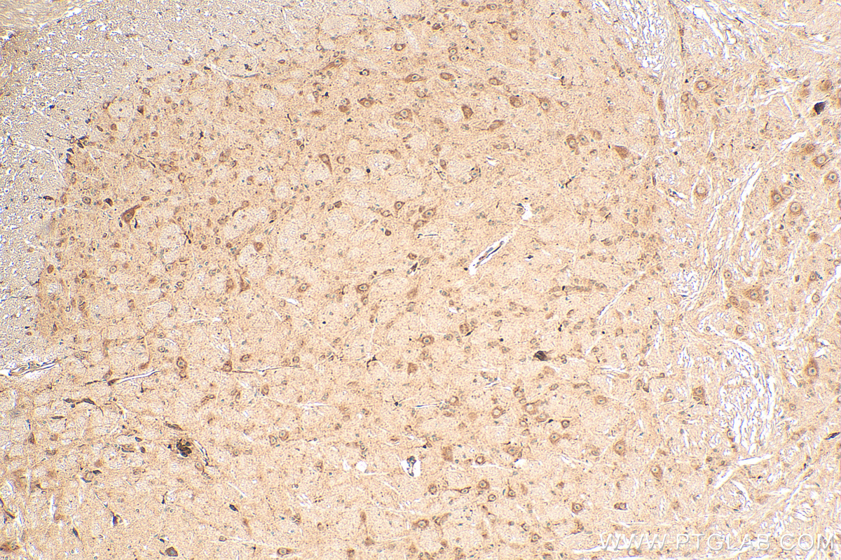 Immunohistochemistry (IHC) staining of mouse cerebellum tissue using RAB3IL1 Polyclonal antibody (17827-1-AP)