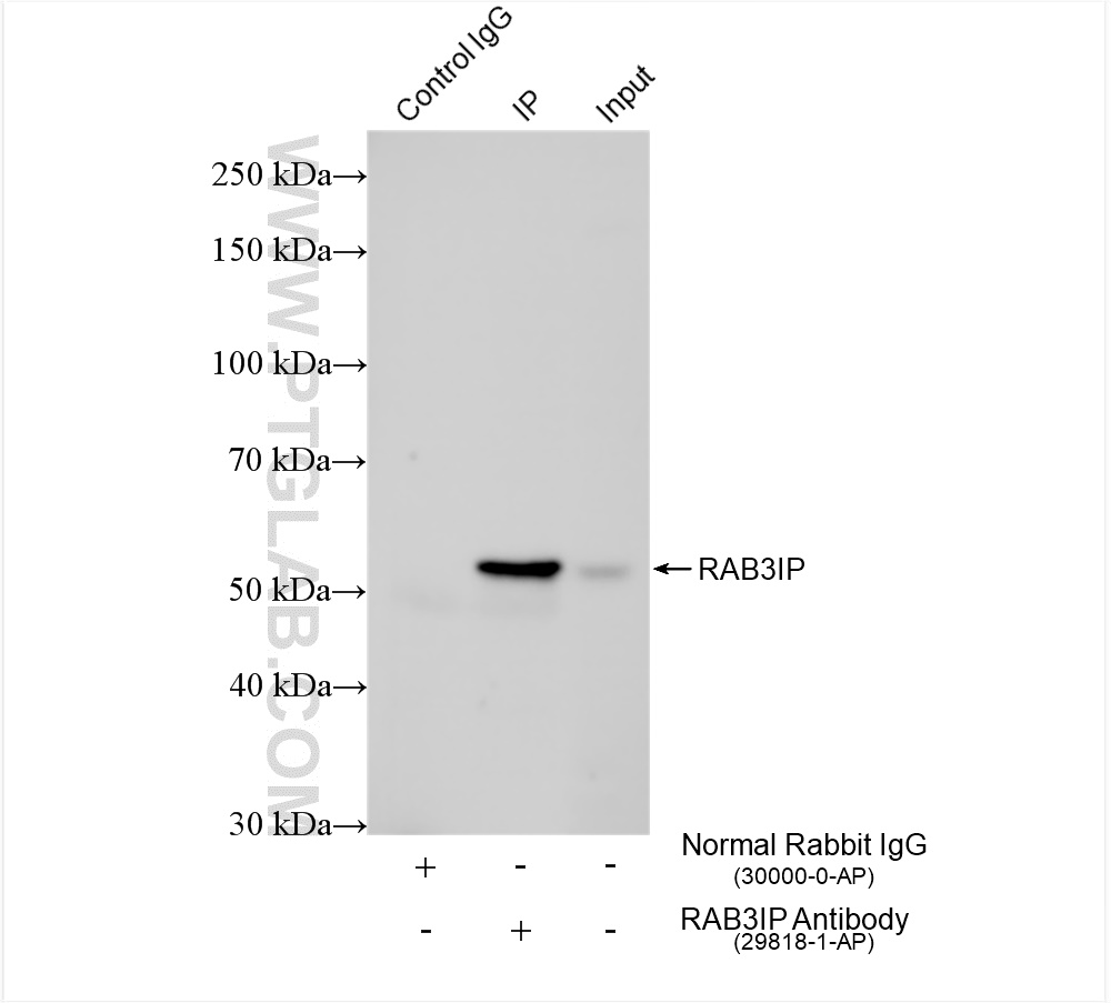 Immunoprecipitation (IP) experiment of Jurkat cells using RAB3IP/Rabin8 Polyclonal antibody (29818-1-AP)