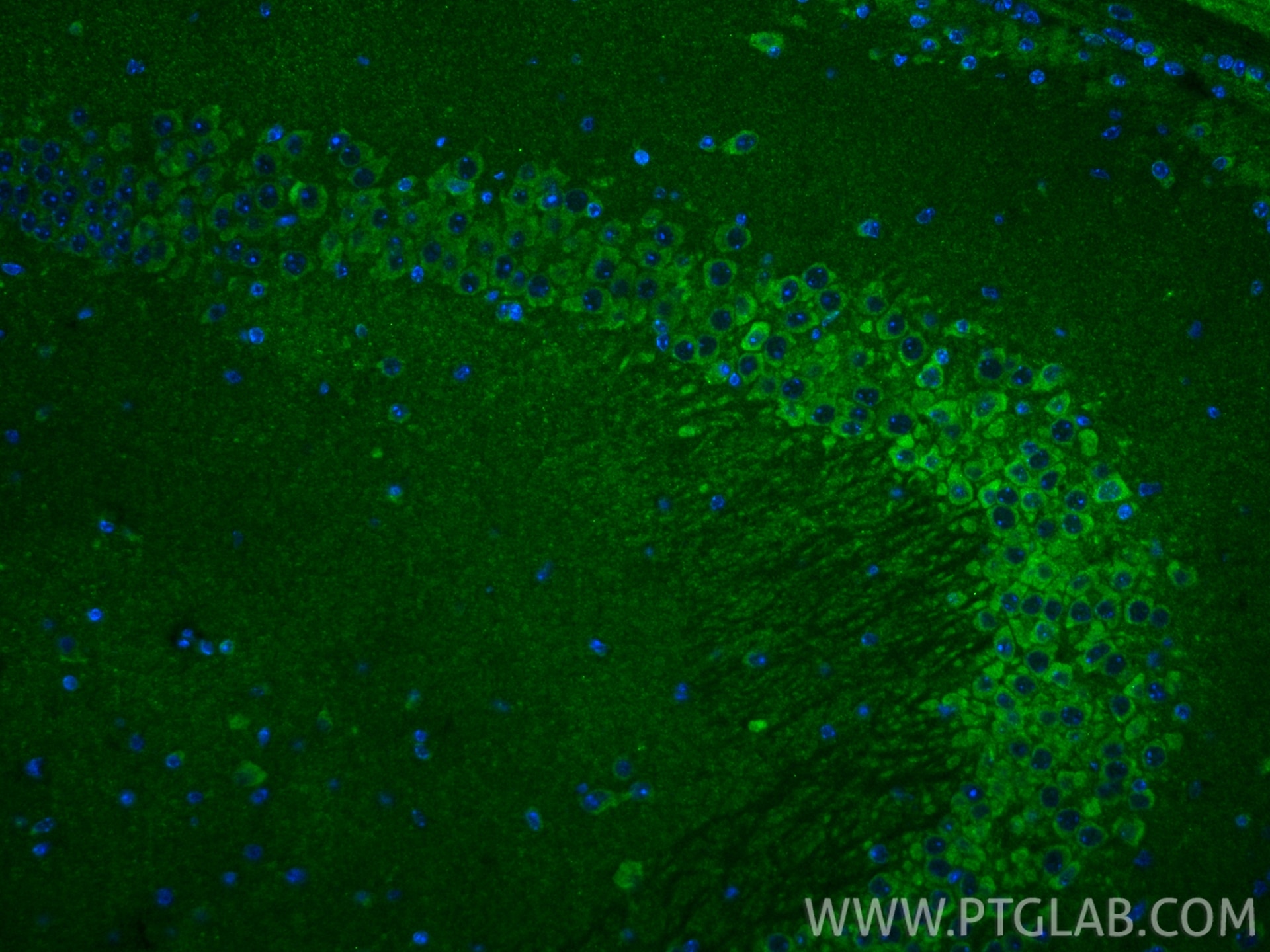 Immunofluorescence (IF) / fluorescent staining of mouse brain tissue using RAB5A Polyclonal antibody (11947-1-AP)