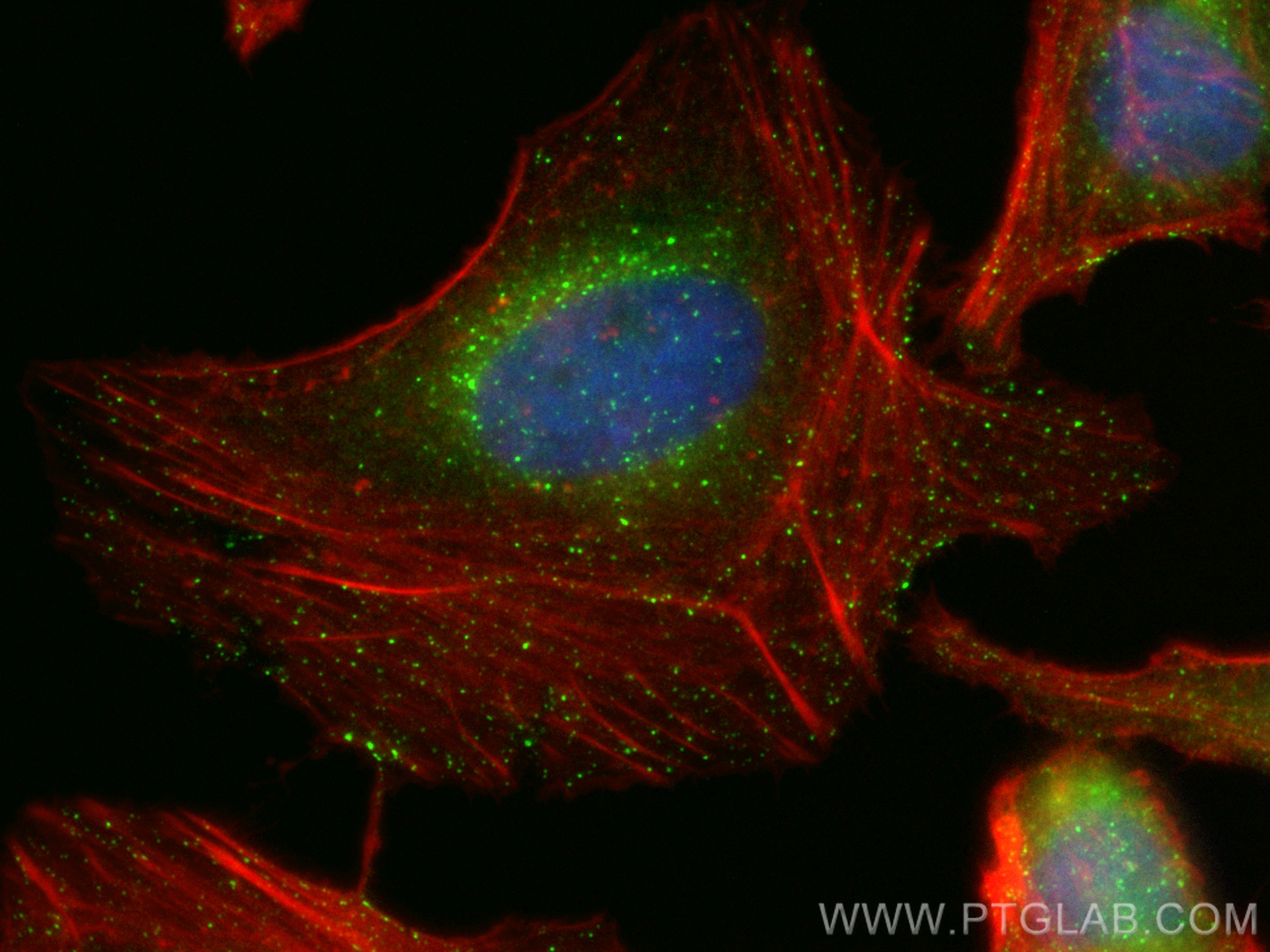 Immunofluorescence (IF) / fluorescent staining of HeLa cells using CoraLite® Plus 488-conjugated RAB5A Monoclonal ant (CL488-66339)