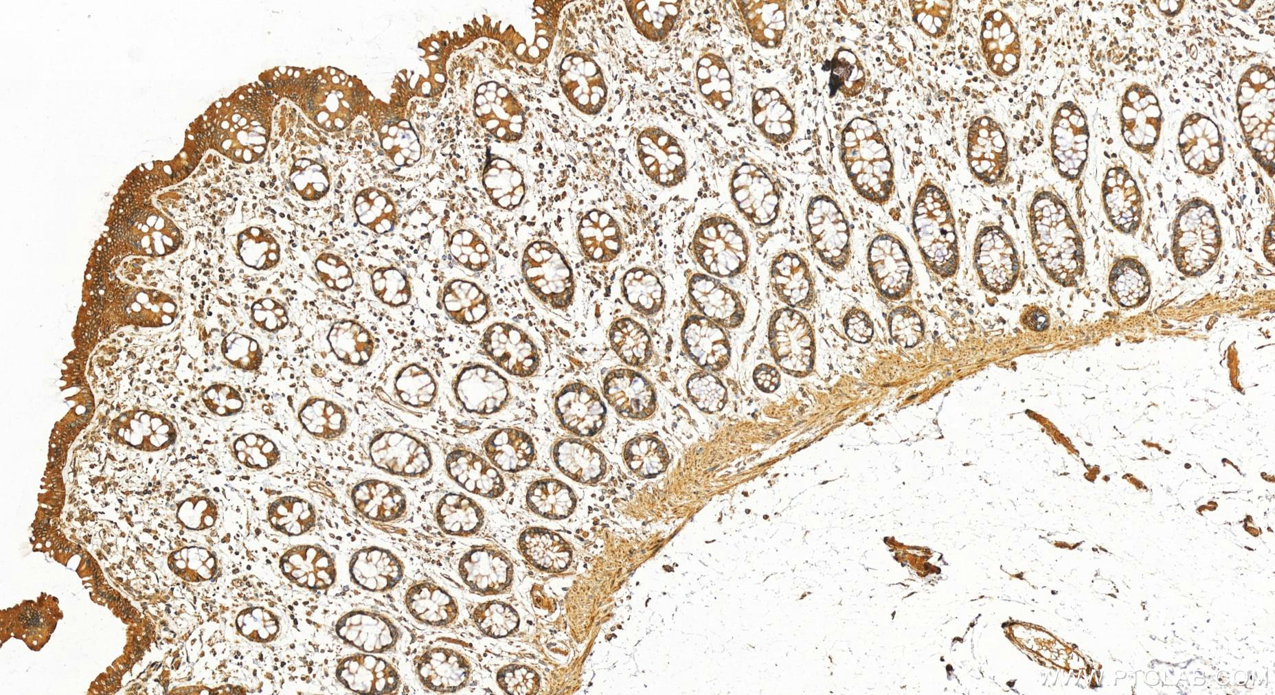 Immunohistochemistry (IHC) staining of human colon tissue using RAB5B Polyclonal antibody (27403-1-AP)