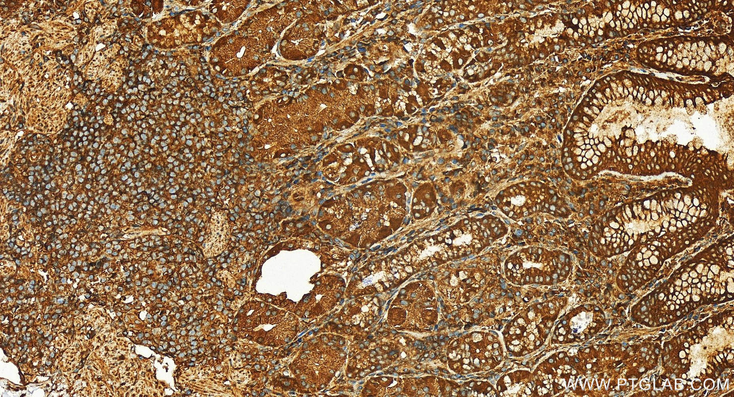 Immunohistochemistry (IHC) staining of human stomach tissue using RAB5B Polyclonal antibody (27403-1-AP)