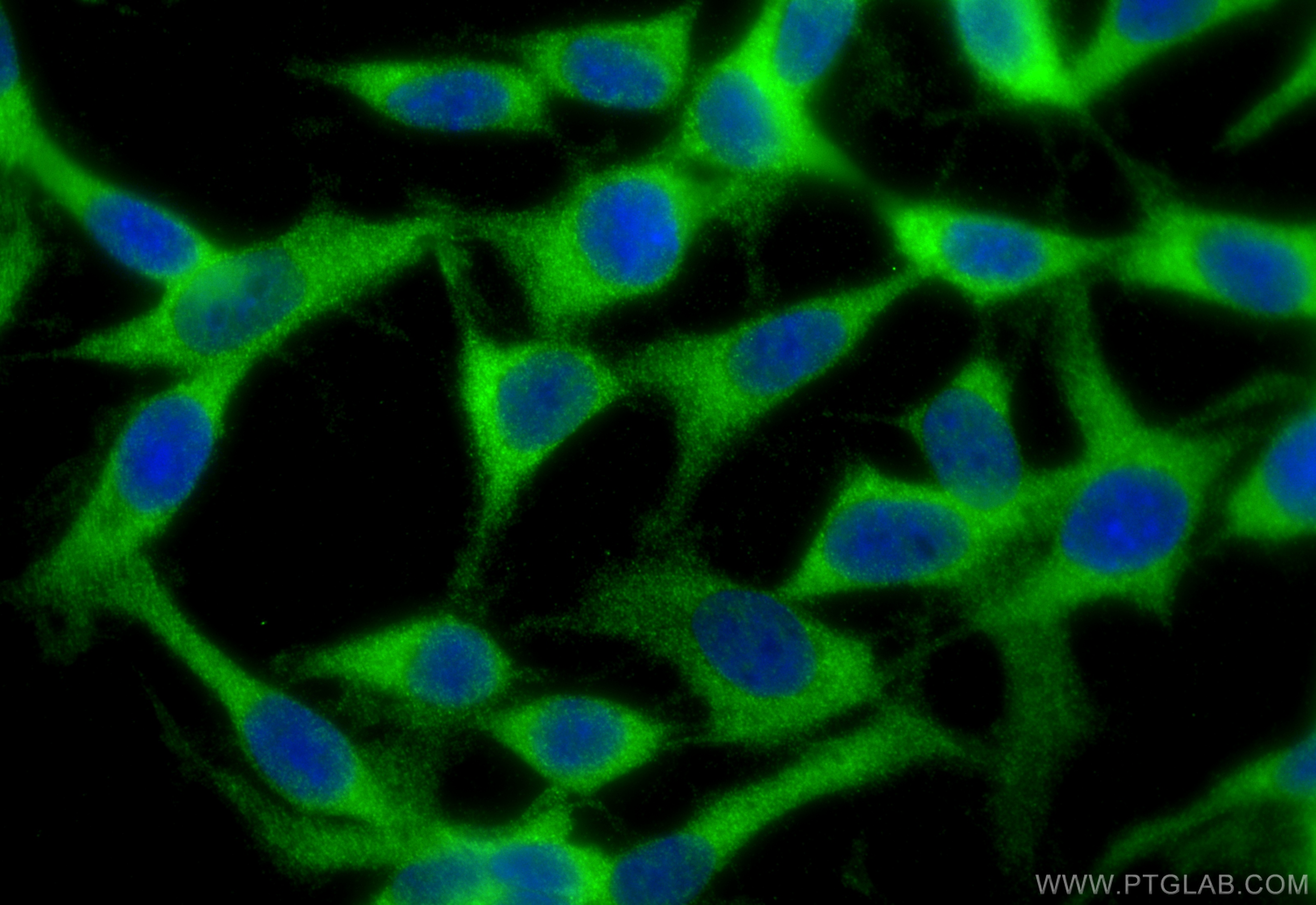 Immunofluorescence (IF) / fluorescent staining of C6 cells using RAB6B Polyclonal antibody (10340-1-AP)