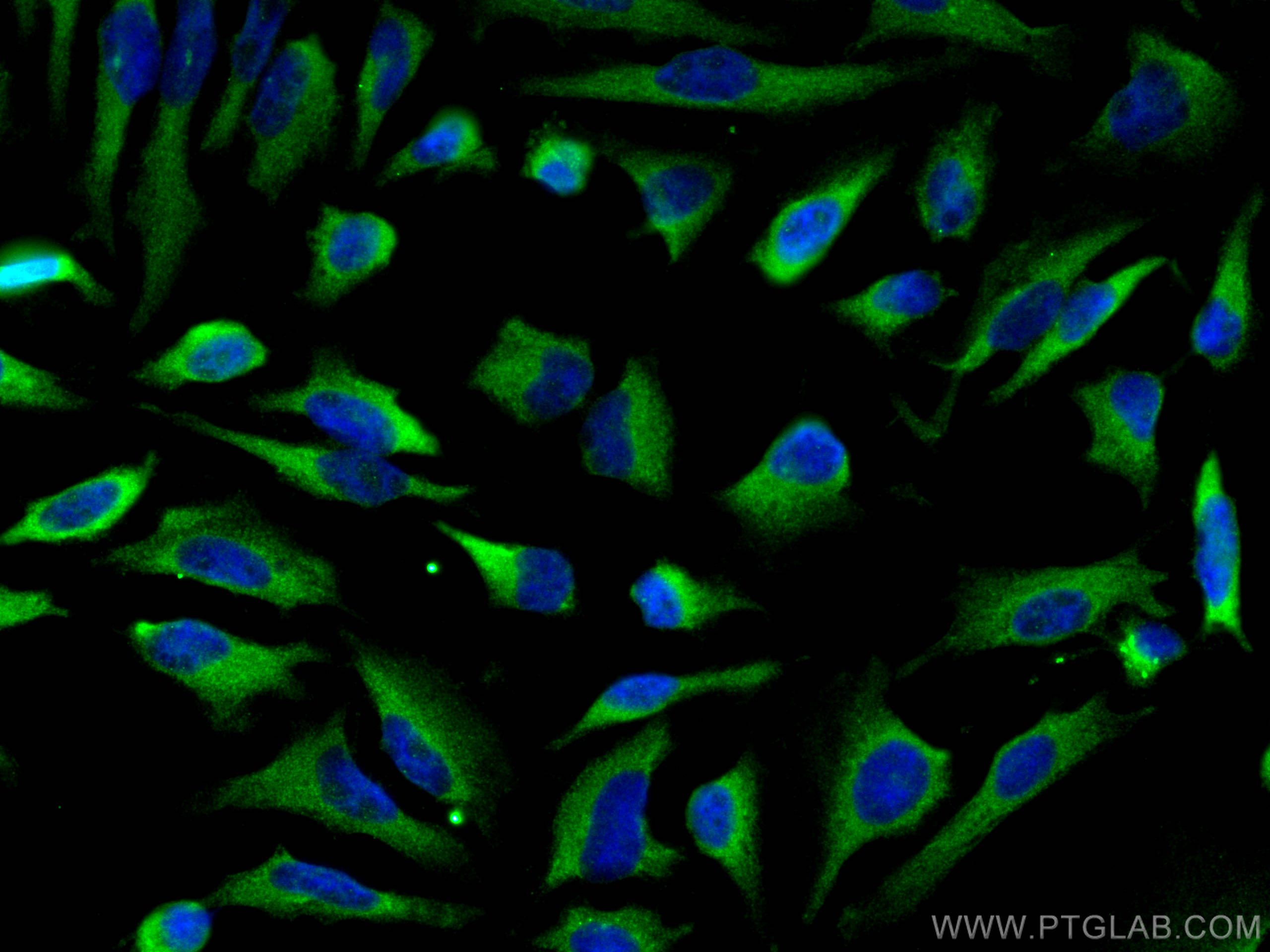 Immunofluorescence (IF) / fluorescent staining of HeLa cells using RAB7A Polyclonal antibody (55469-1-AP)