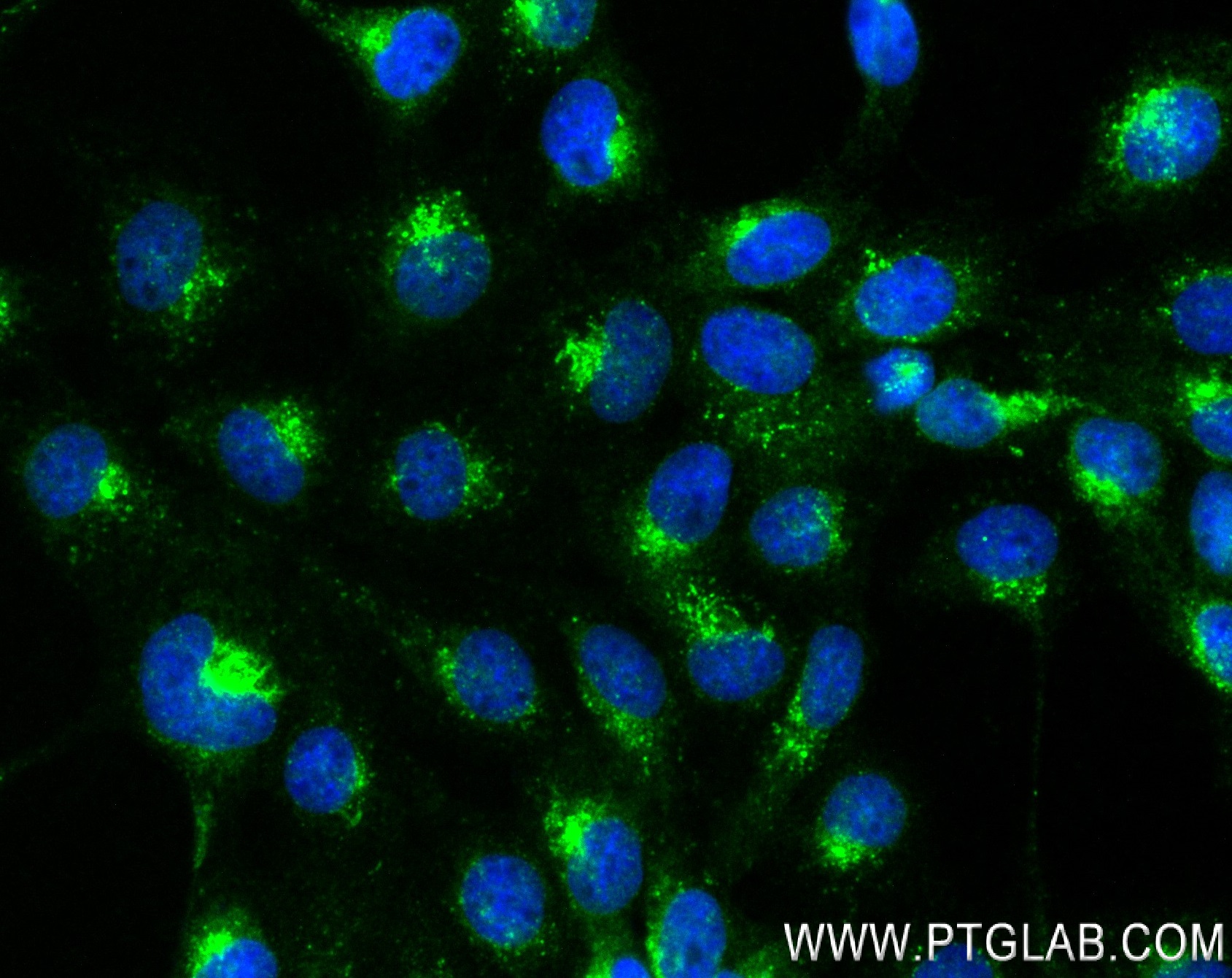 Immunofluorescence (IF) / fluorescent staining of A431 cells using RAB7A Recombinant antibody (84741-1-RR)