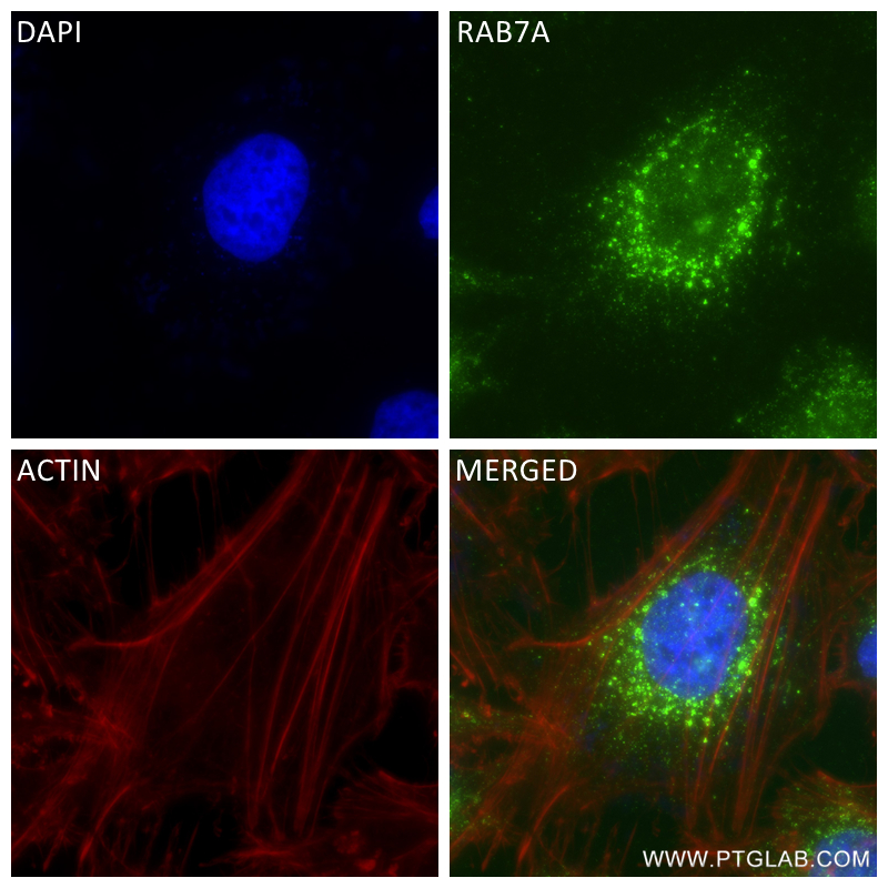 Immunofluorescence (IF) / fluorescent staining of HeLa cells using RAB7A Recombinant antibody (84741-1-RR)