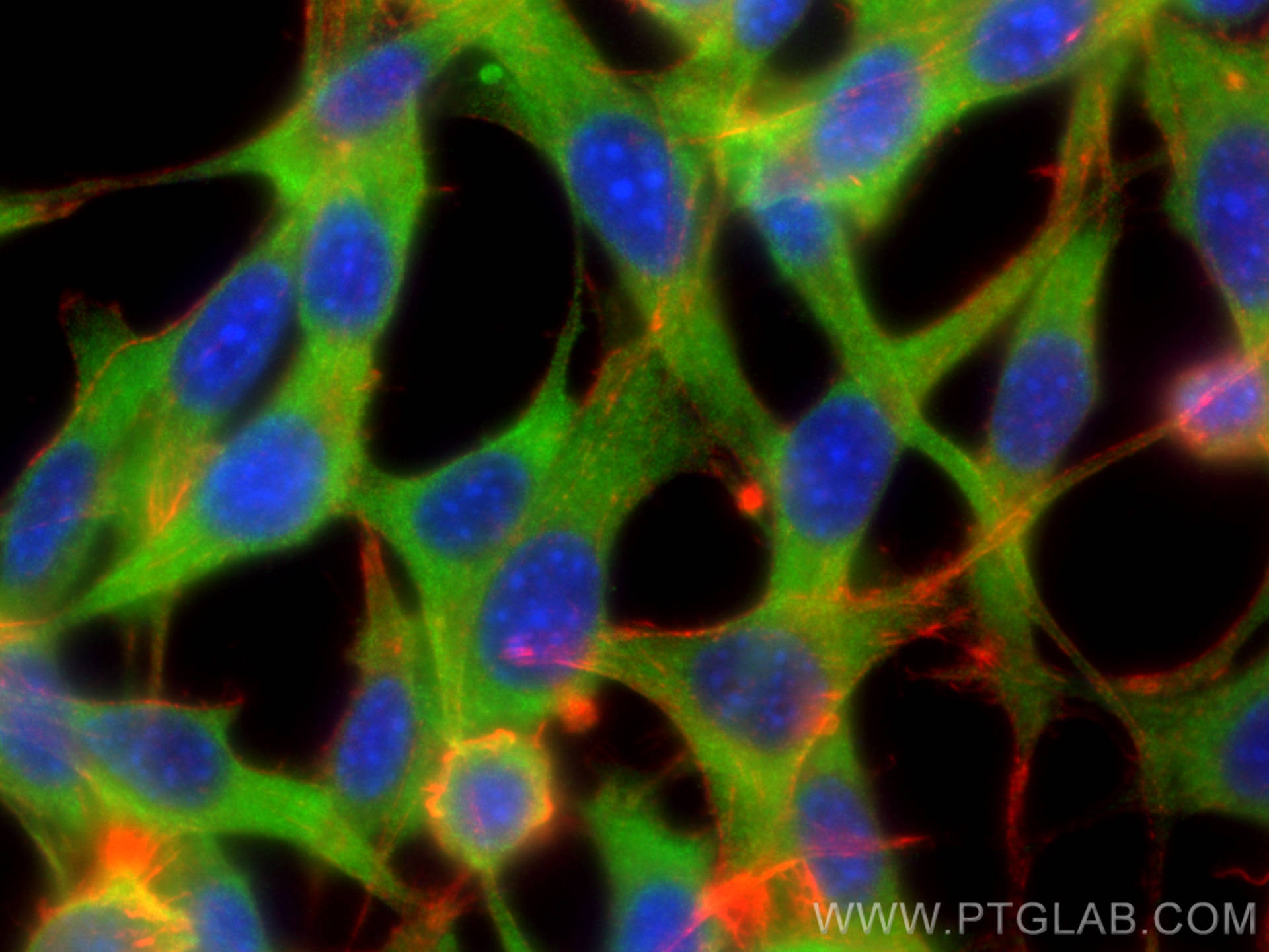 Immunofluorescence (IF) / fluorescent staining of NIH/3T3 cells using RAB8A Polyclonal antibody (55296-1-AP)