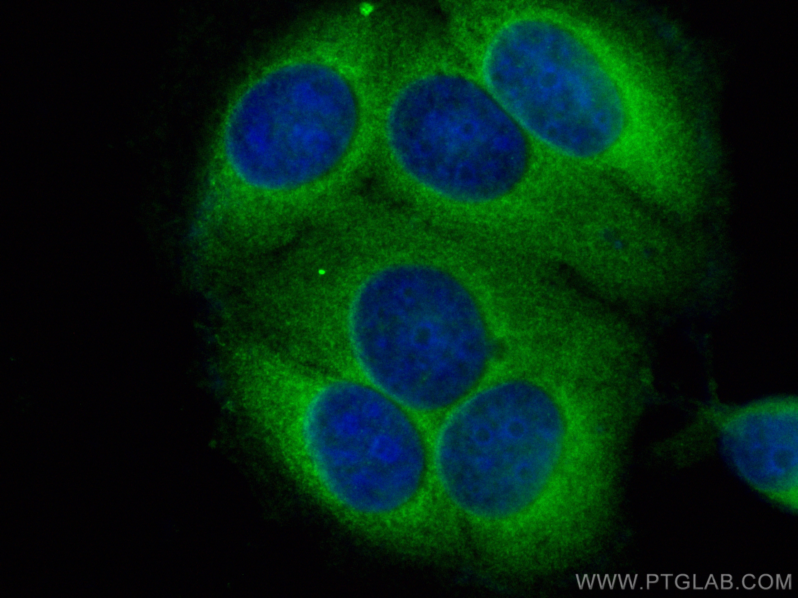 Immunofluorescence (IF) / fluorescent staining of MCF-7 cells using CoraLite® Plus 488-conjugated RABEP2 Polyclonal an (CL488-14625)