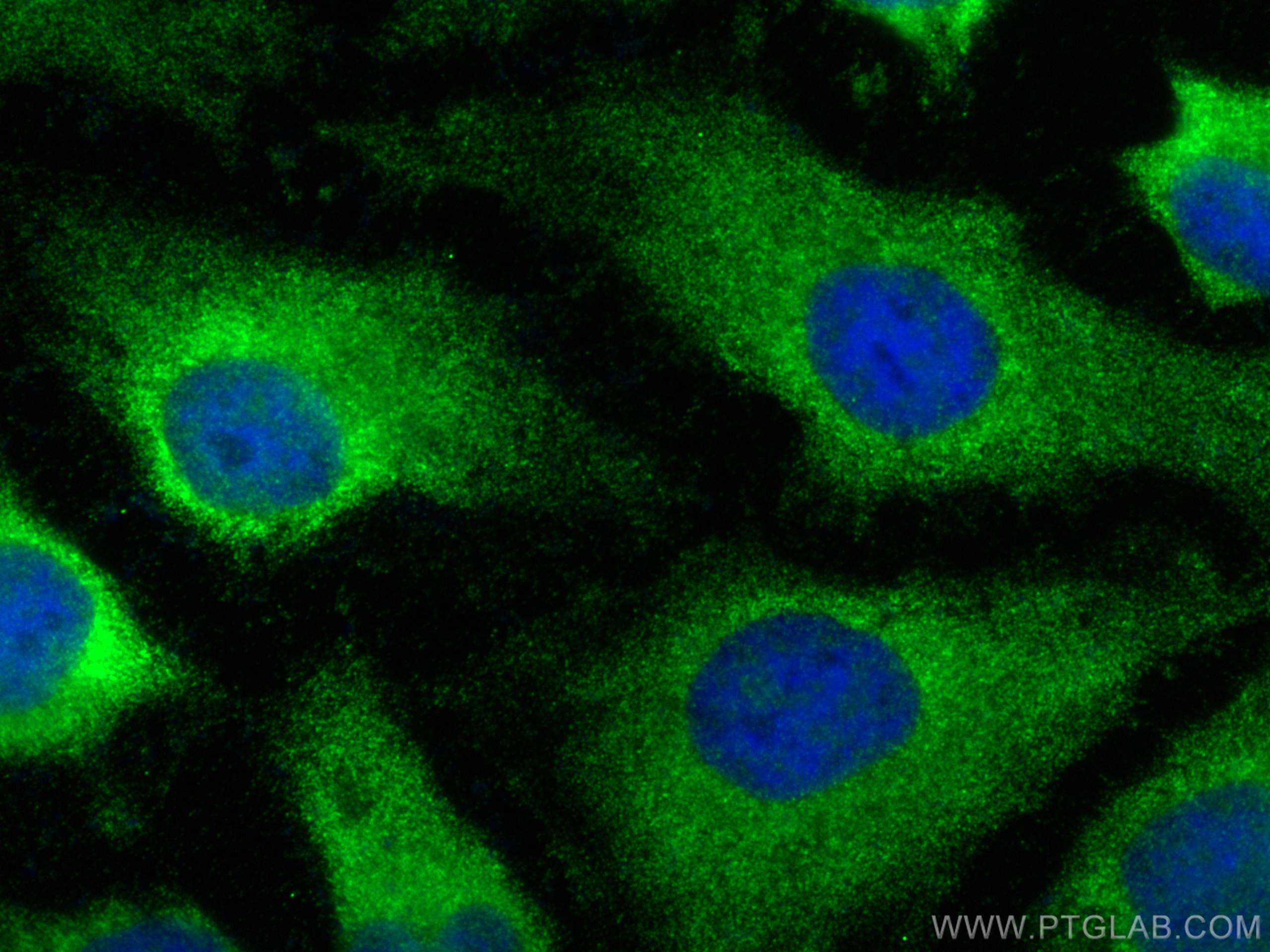 Immunofluorescence (IF) / fluorescent staining of HeLa cells using RABEPK/p40 Polyclonal antibody (15105-1-AP)
