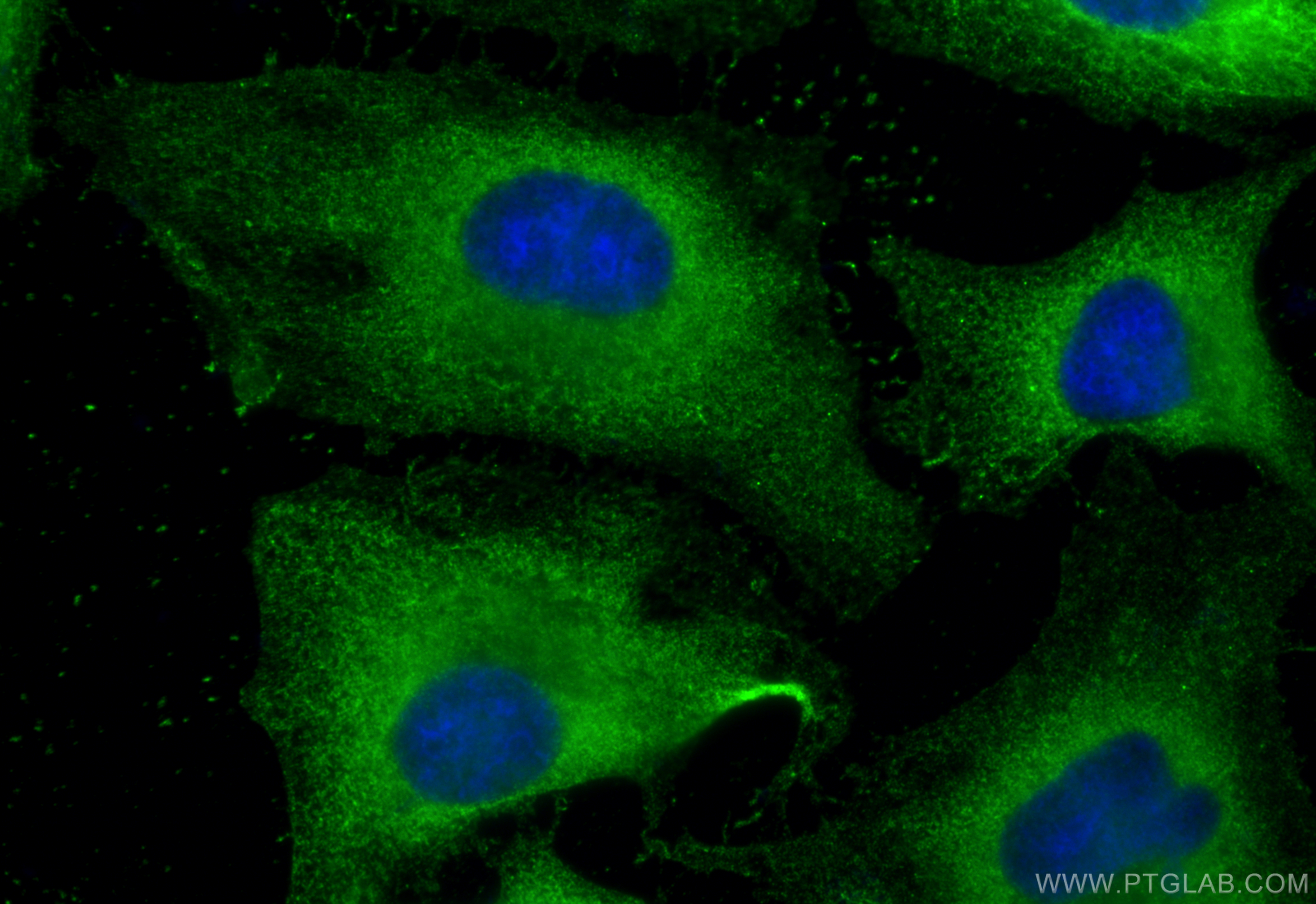 Immunofluorescence (IF) / fluorescent staining of HeLa cells using RABEPK/p40 Monoclonal antibody (66622-1-Ig)