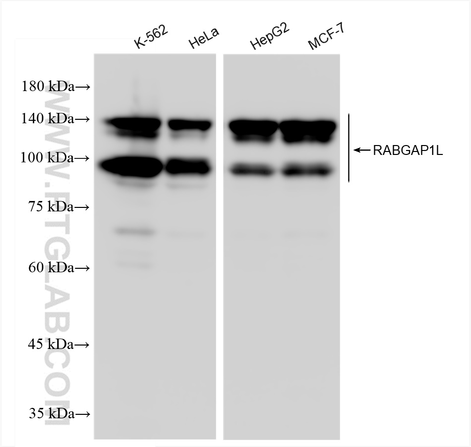 Western Blot (WB) analysis of various lysates using RABGAP1L Recombinant antibody (83698-4-RR)