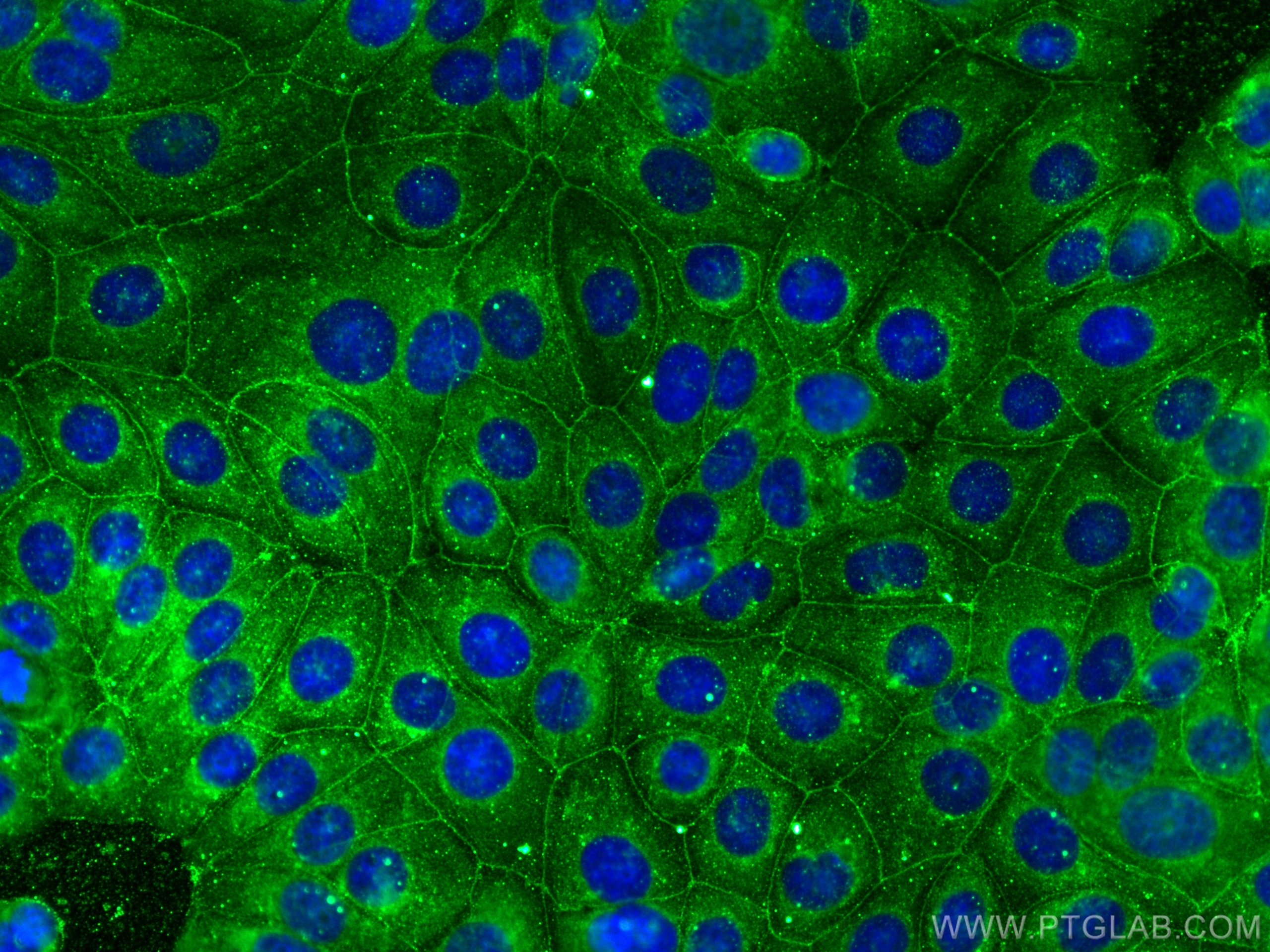 Immunofluorescence (IF) / fluorescent staining of MCF-7 cells using RABIF Polyclonal antibody (29113-1-AP)