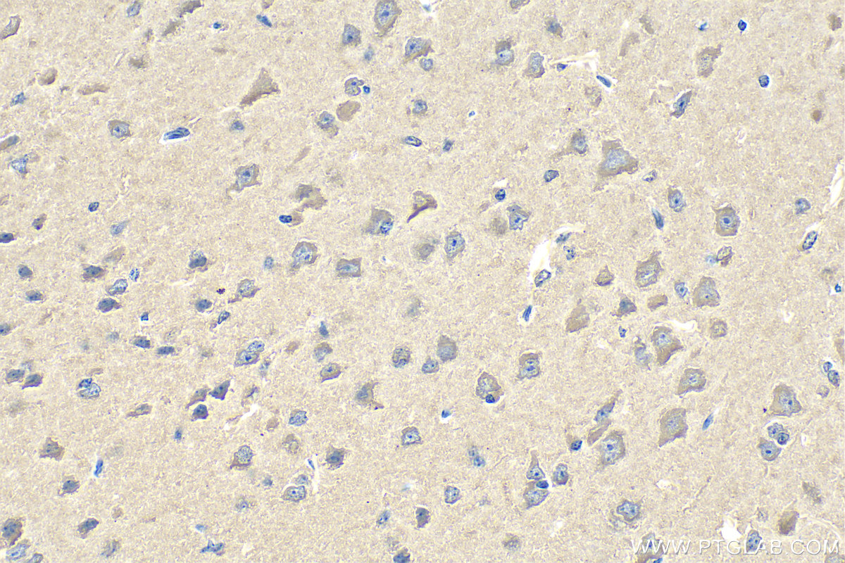 Immunohistochemistry (IHC) staining of mouse brain tissue using RABIF Polyclonal antibody (29113-1-AP)