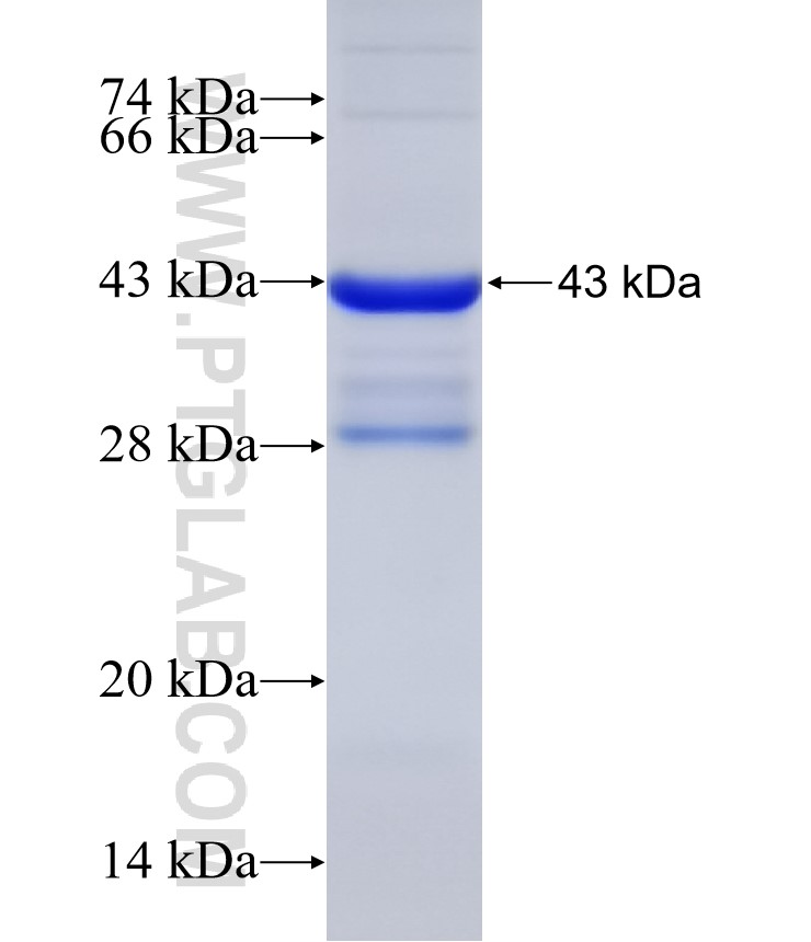 RABIN8 fusion protein Ag31291 SDS-PAGE