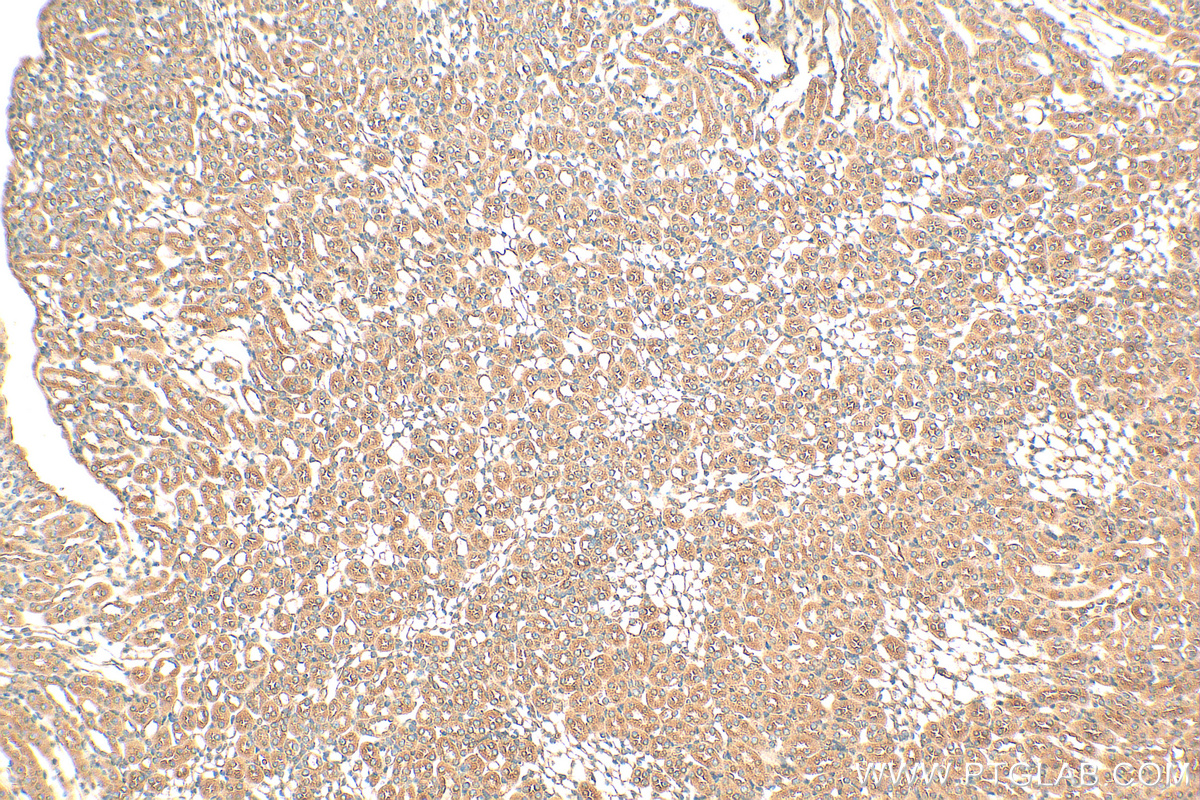 Immunohistochemistry (IHC) staining of mouse kidney tissue using RABL2B Polyclonal antibody (11588-1-AP)